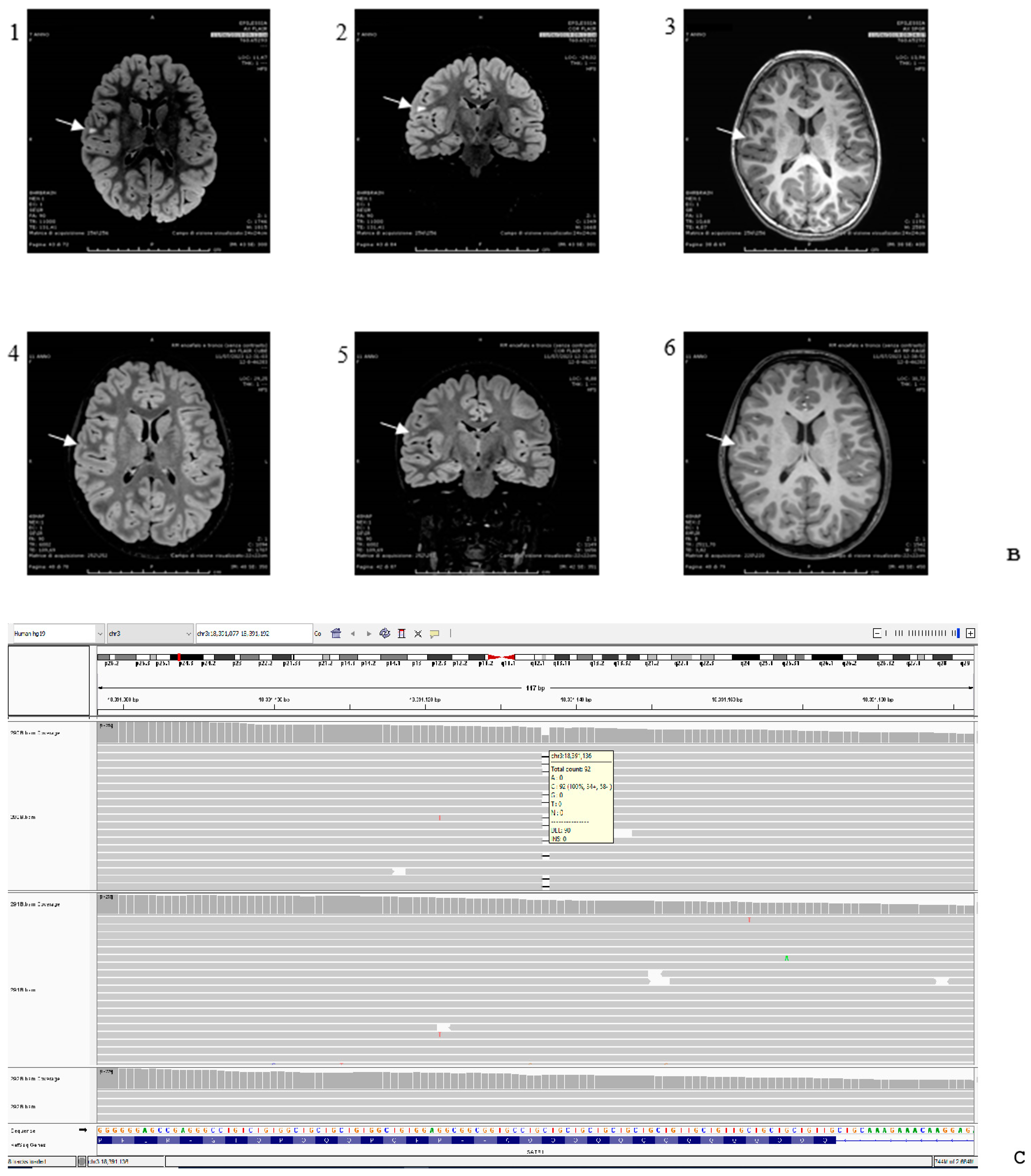 Genes 15 00548 g002b