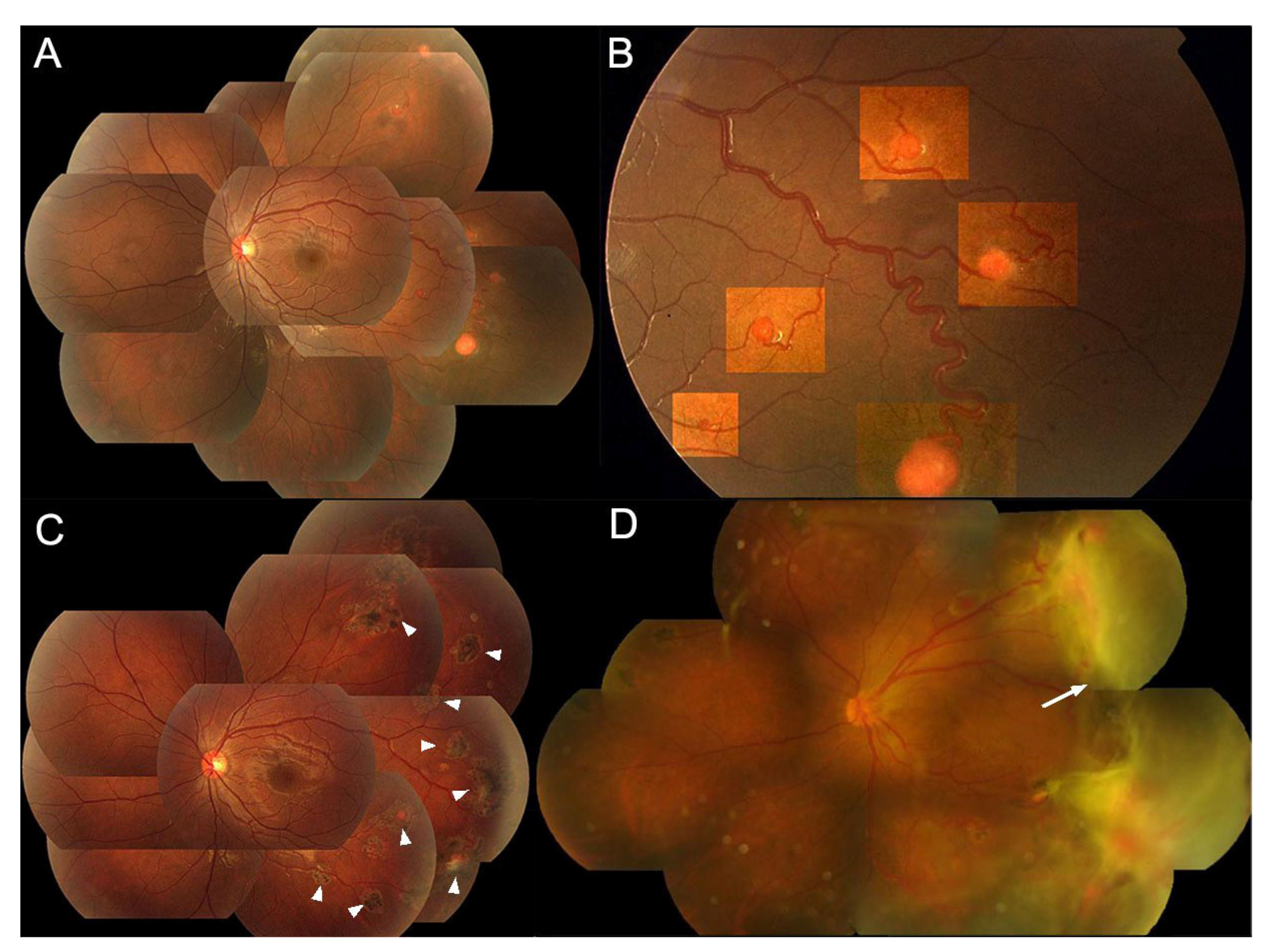 Genes 15 01192 g005 Genes 15 01192 g005