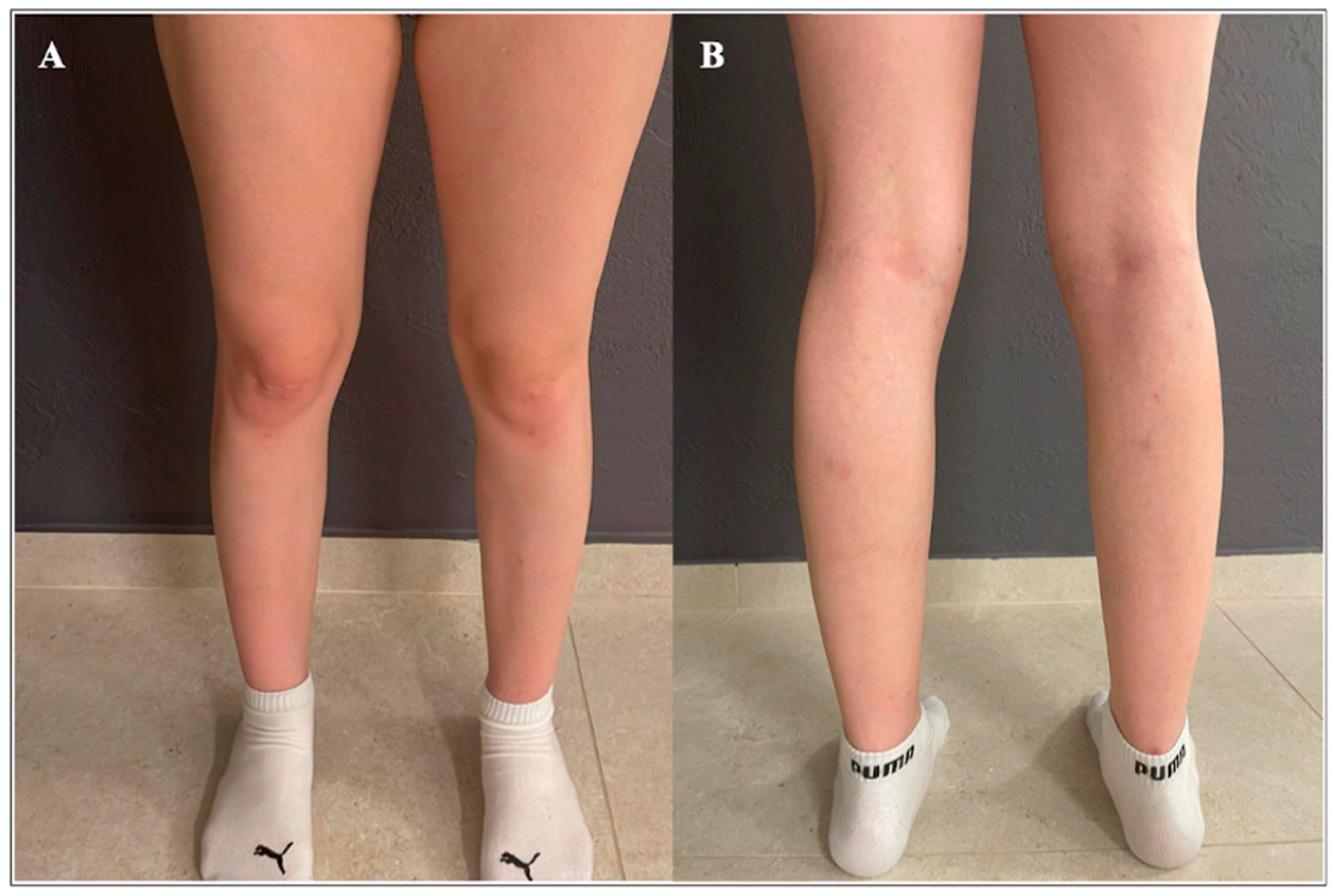 Genes 15 01300 g001 Genes 15 01300 g001