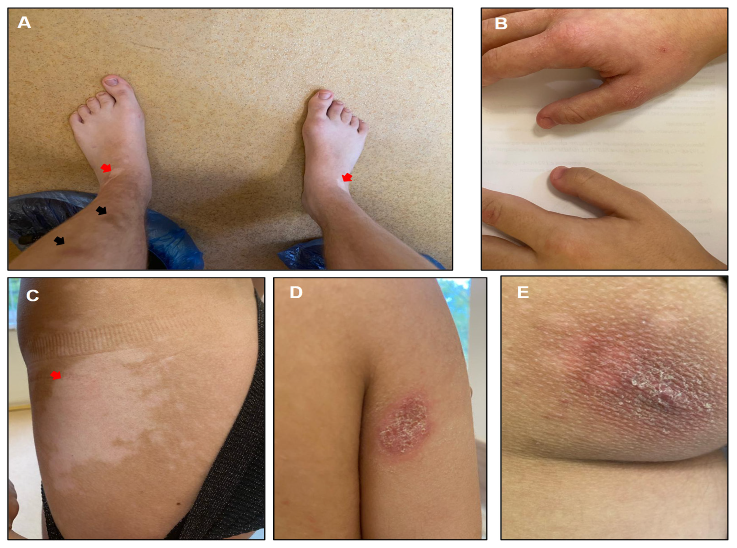 Genes 15 01406 g001 Genes 15 01406 g001