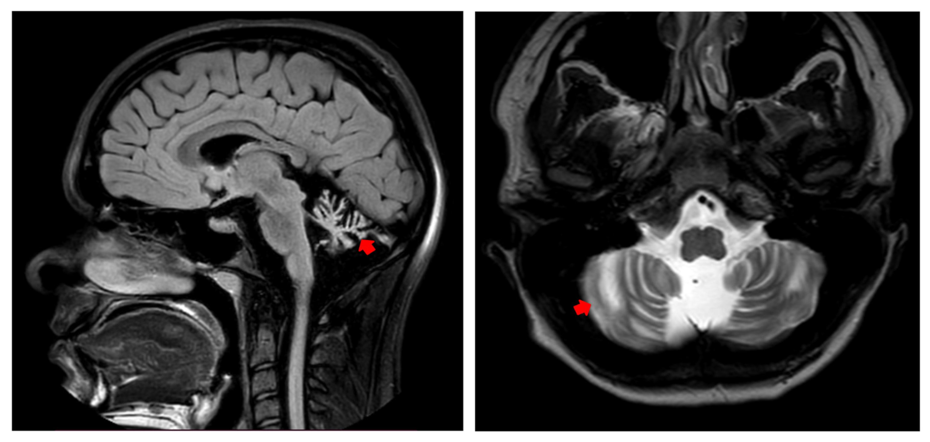 Genes 15 01406 g002 Genes 15 01406 g002