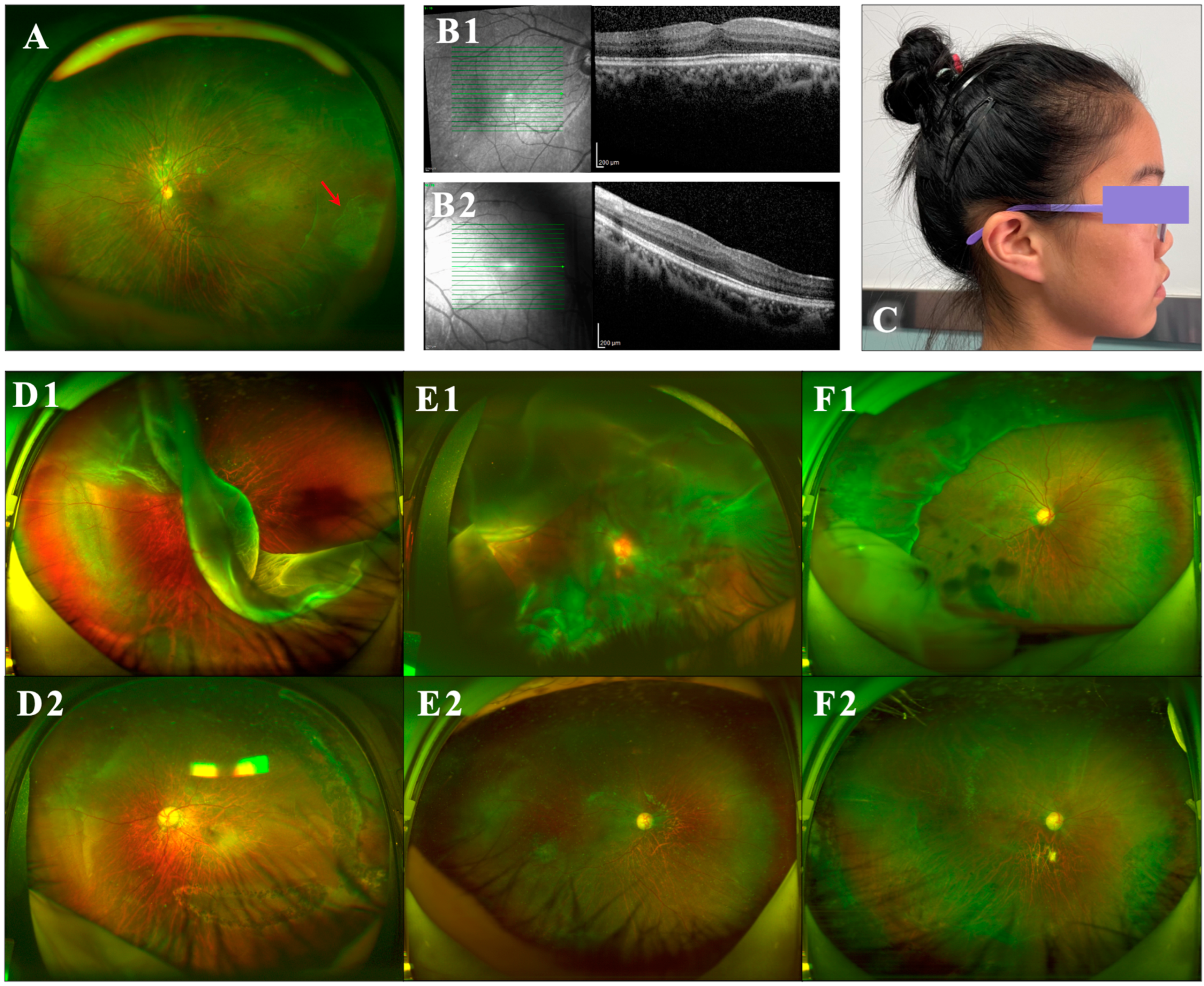 Genes 15 01455 g002 Genes 15 01455 g002