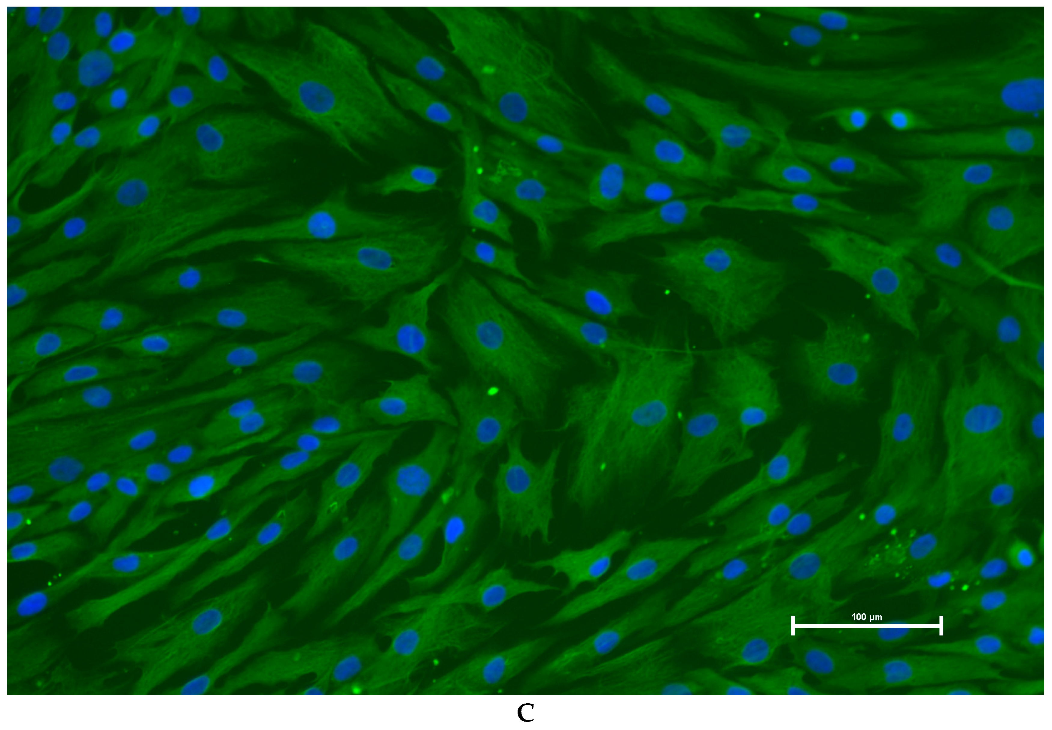 Genes 16 00731 g004b