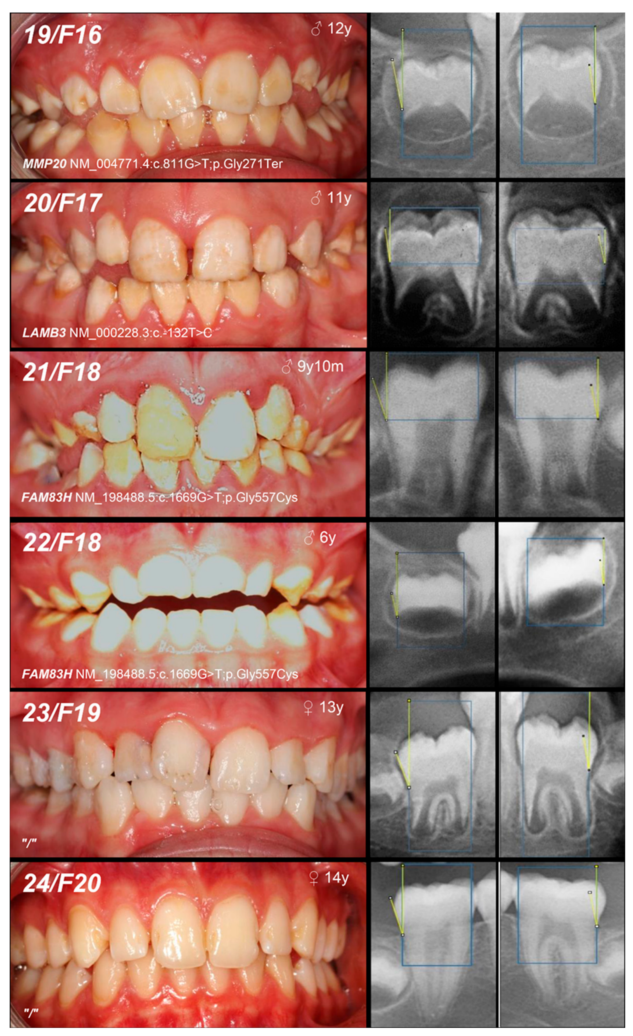 Genes 16 00822 g002d