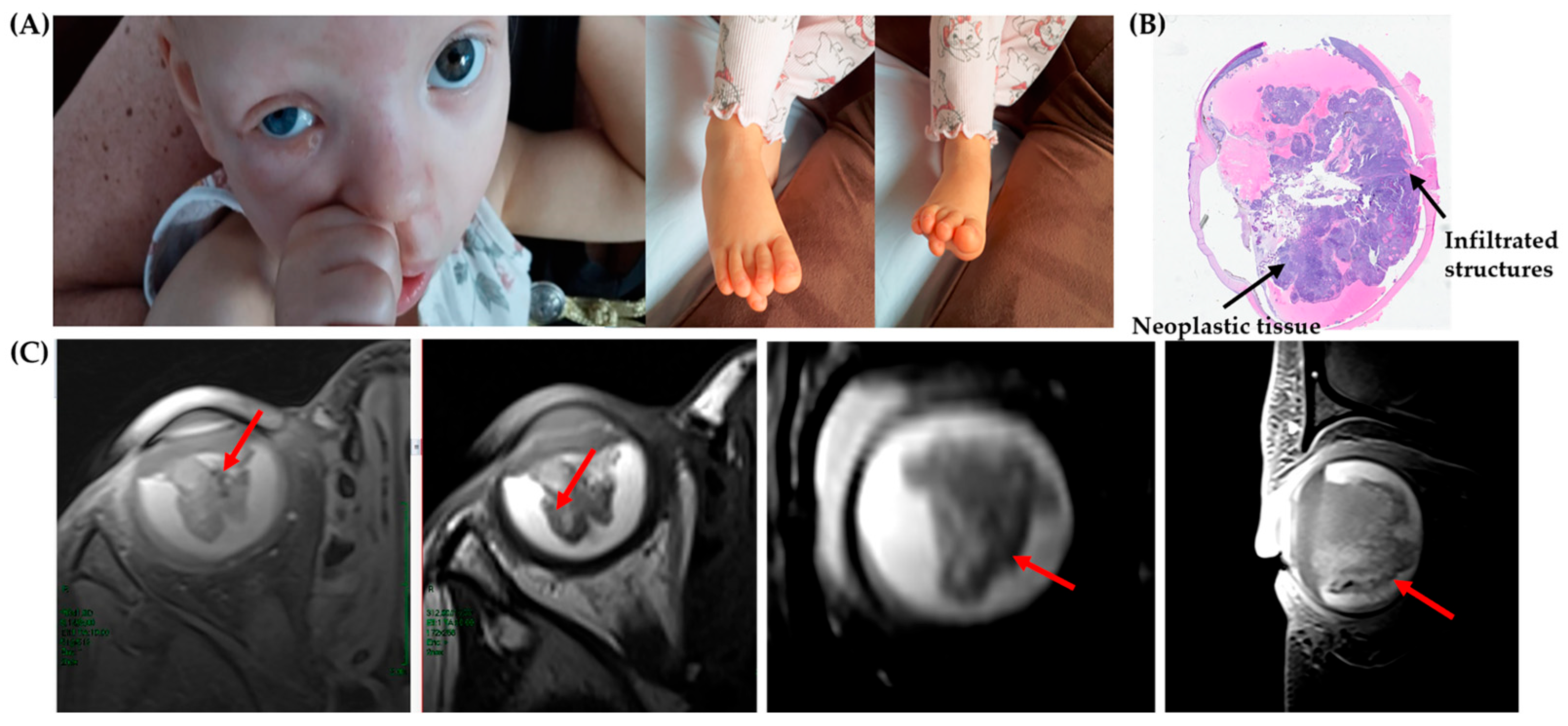 Genes 16 01399 g002 Genes 16 01399 g002