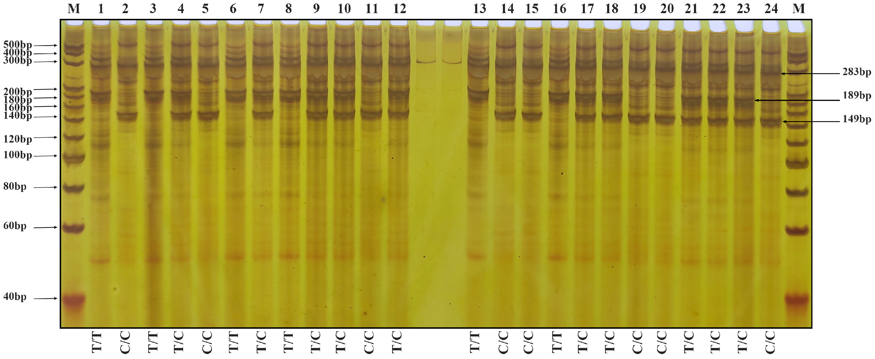 Genes 17 00089 g004 Genes 17 00089 g004