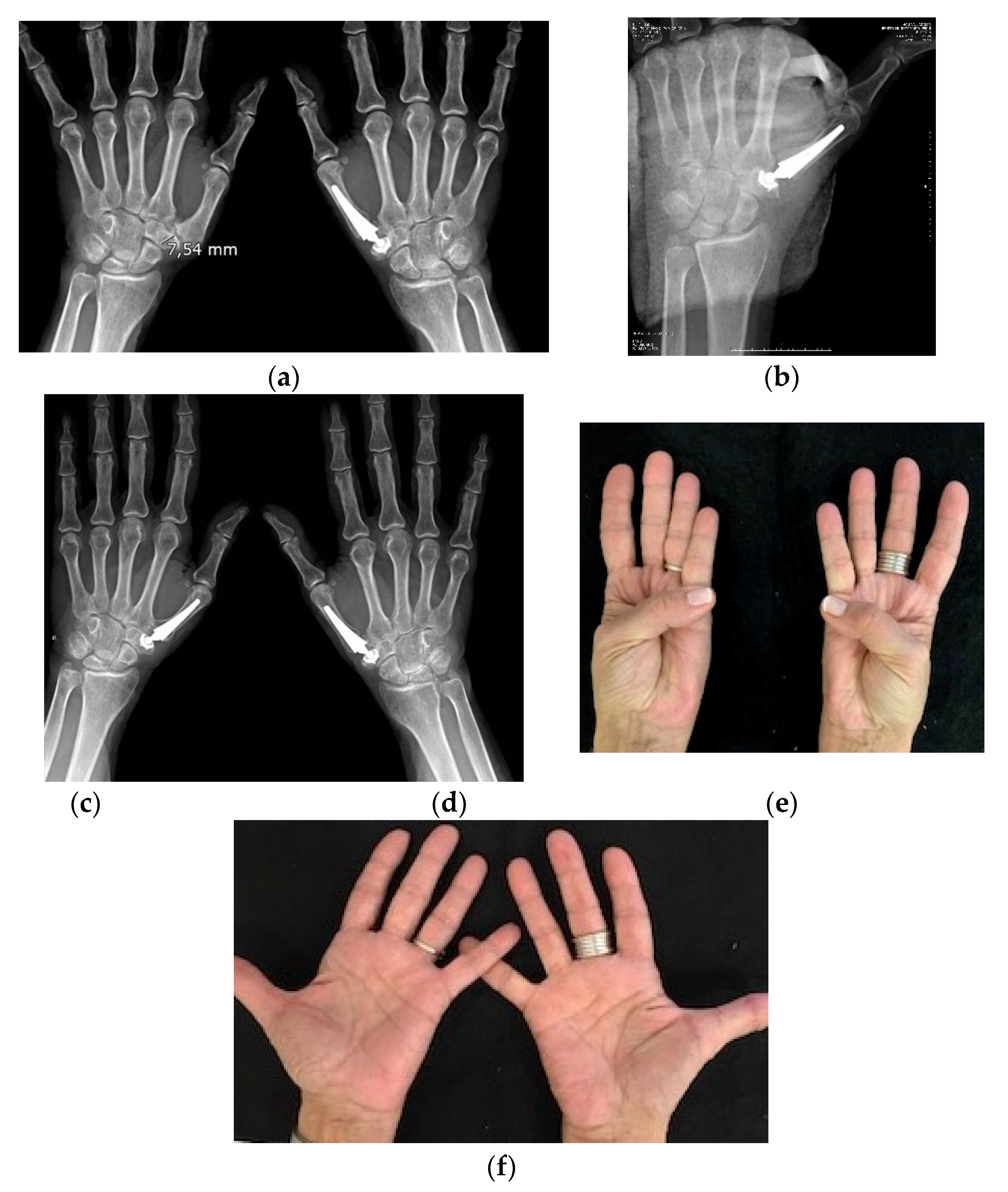 Geriatrics 06 00065 g002 550