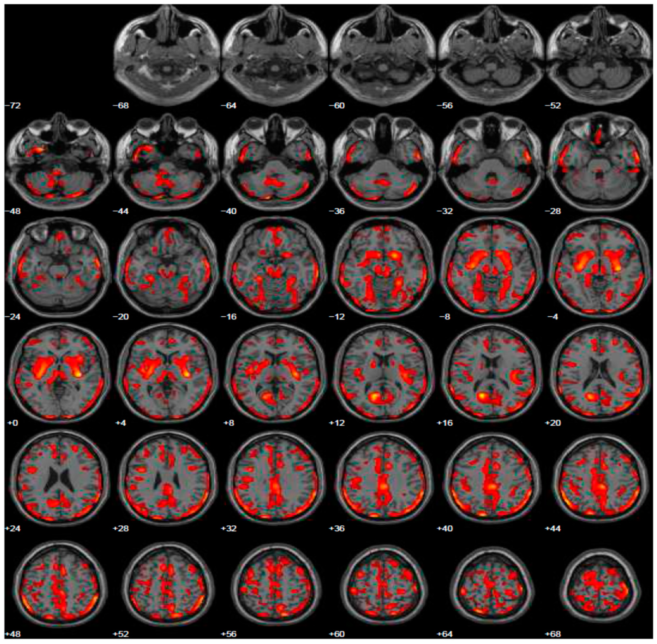 Geriatrics 06 00110 g002 550