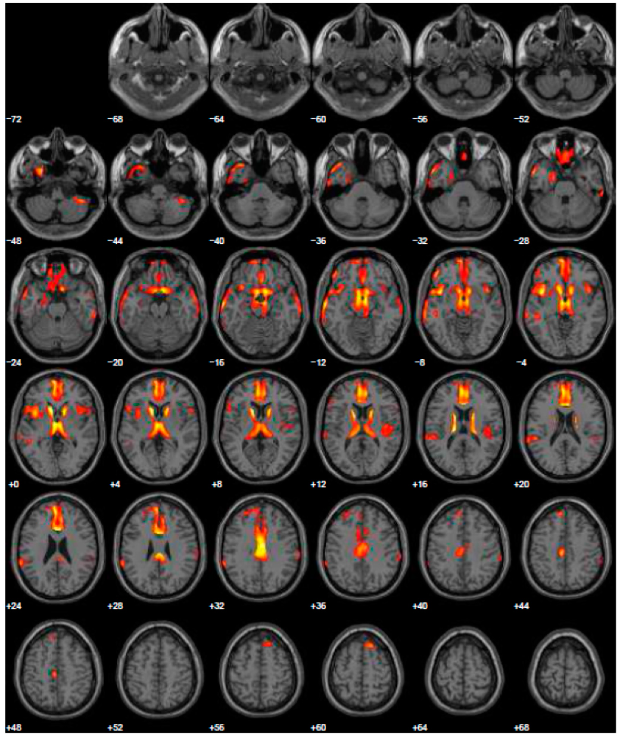Geriatrics 06 00110 g003 550