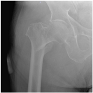 Geriatrics 07 00018 i002 Geriatrics 07 00018 i002