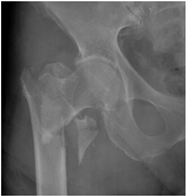 Geriatrics 07 00018 i003 Geriatrics 07 00018 i003