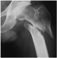 Geriatrics 07 00018 i004 Geriatrics 07 00018 i004