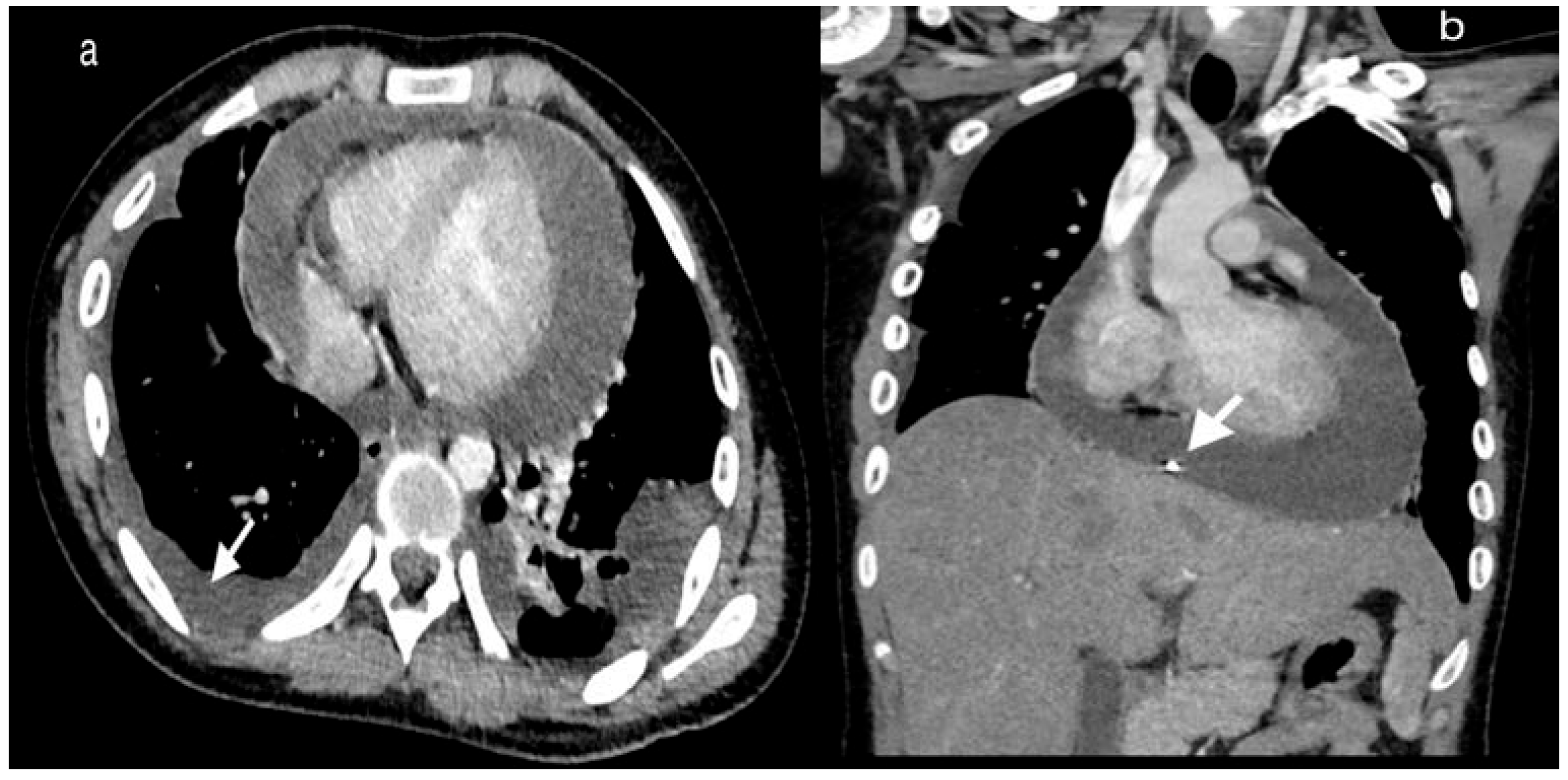 Germs 10 00249 g001 Germs 10 00249 g001