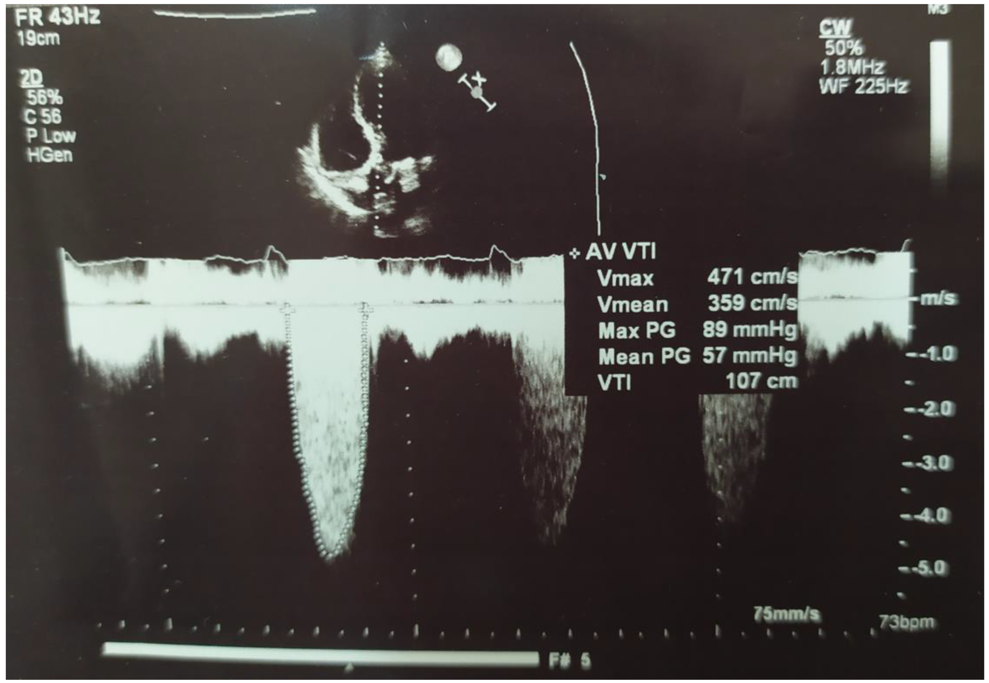 Germs 10 00254 g001 Germs 10 00254 g001