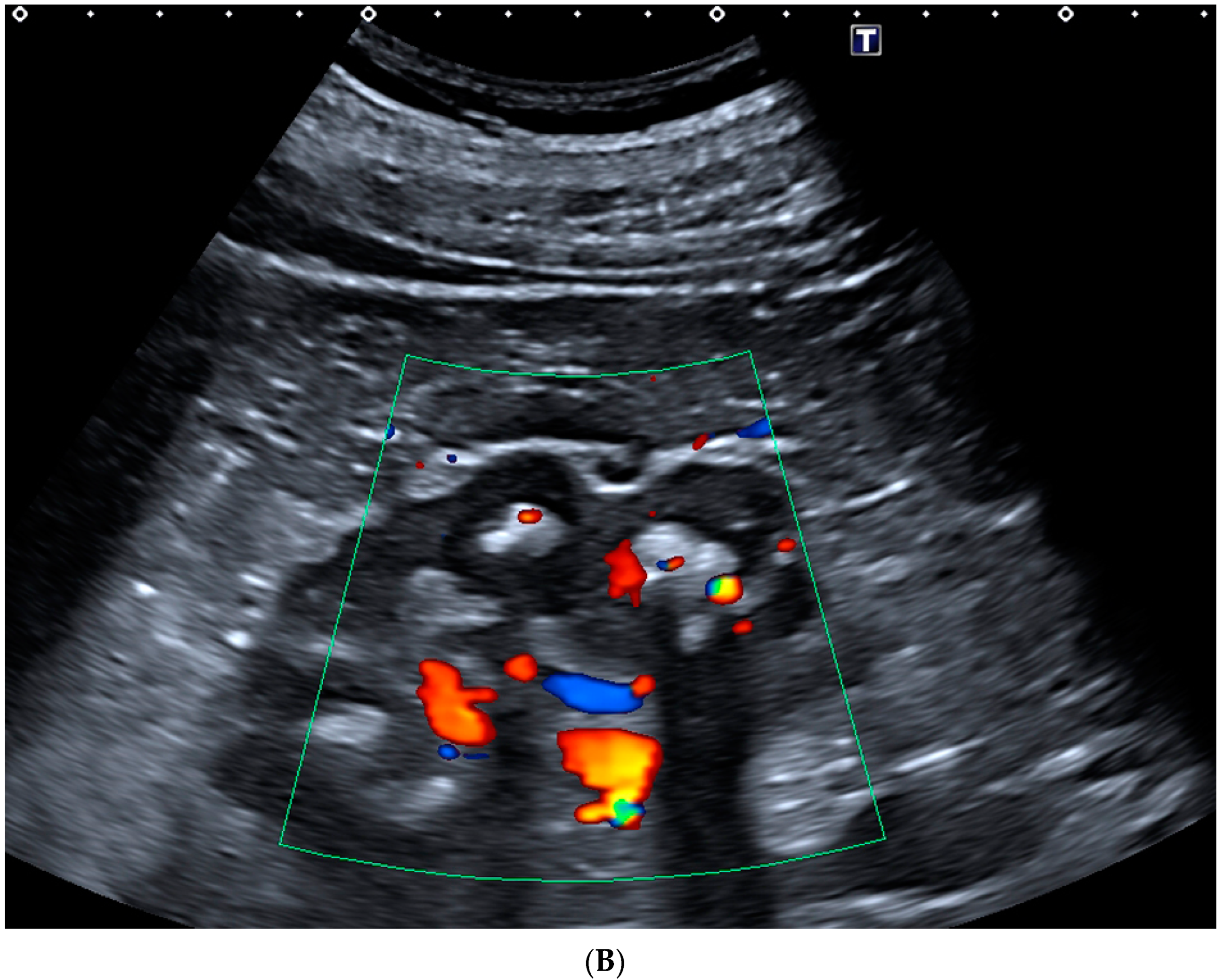 Gucdd 01 00004 g003b