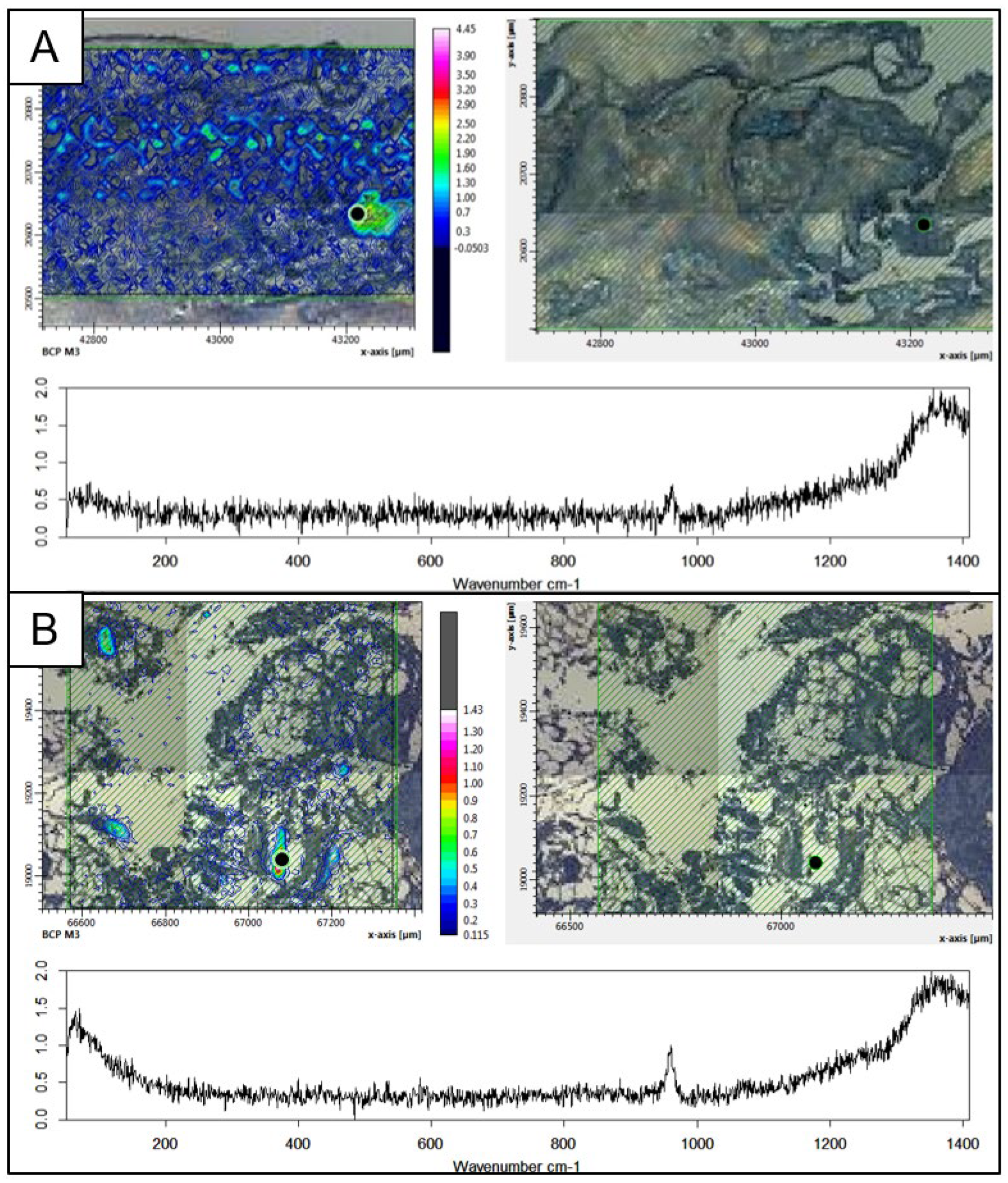 Gucdd 01 00007 g011 Gucdd 01 00007 g011