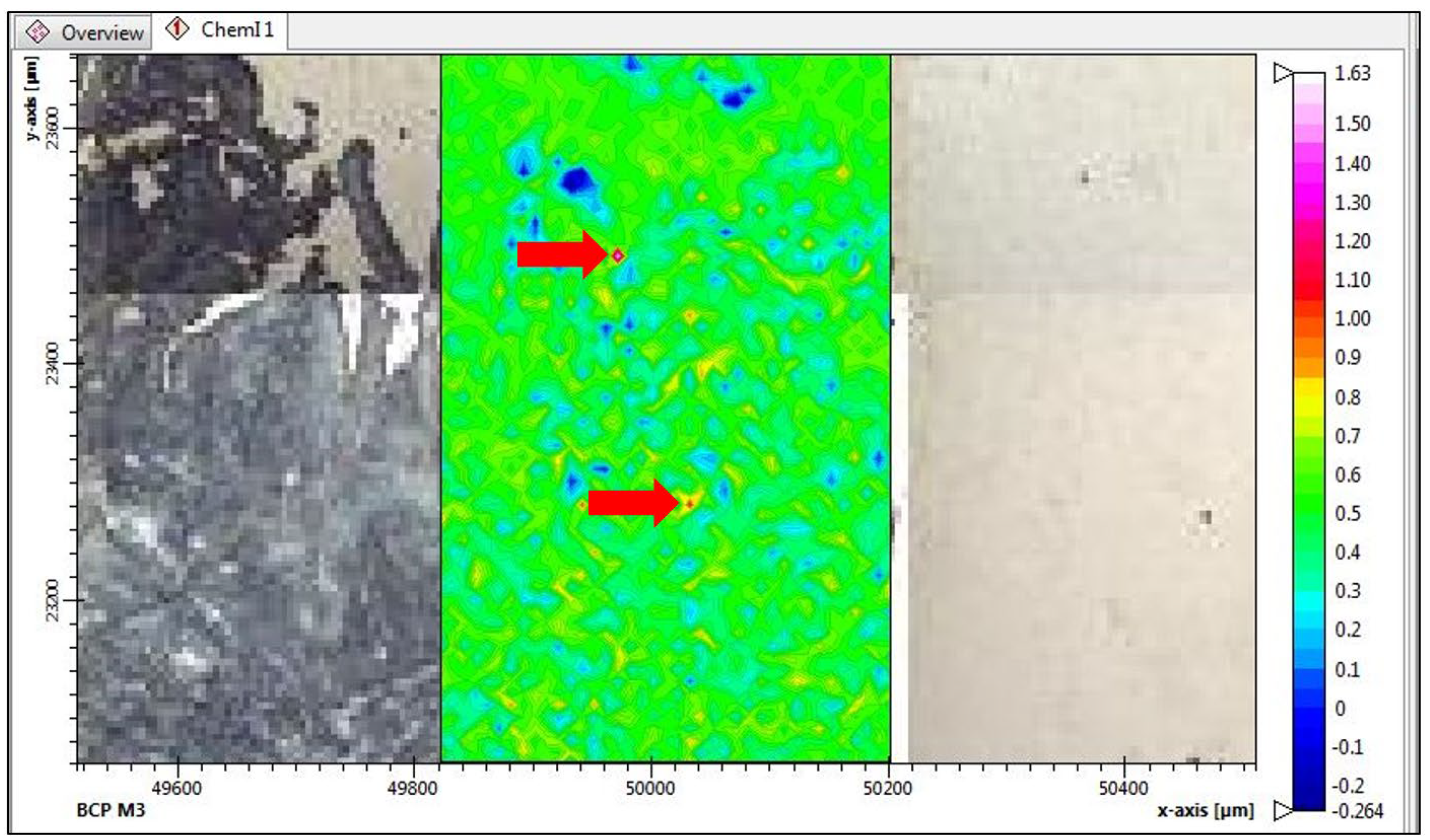 Gucdd 01 00007 g013 Gucdd 01 00007 g013