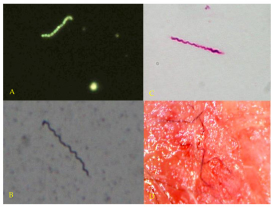 Persistent Borrelia Infection in Patients with Ongoing Symptoms of Lyme Disease
