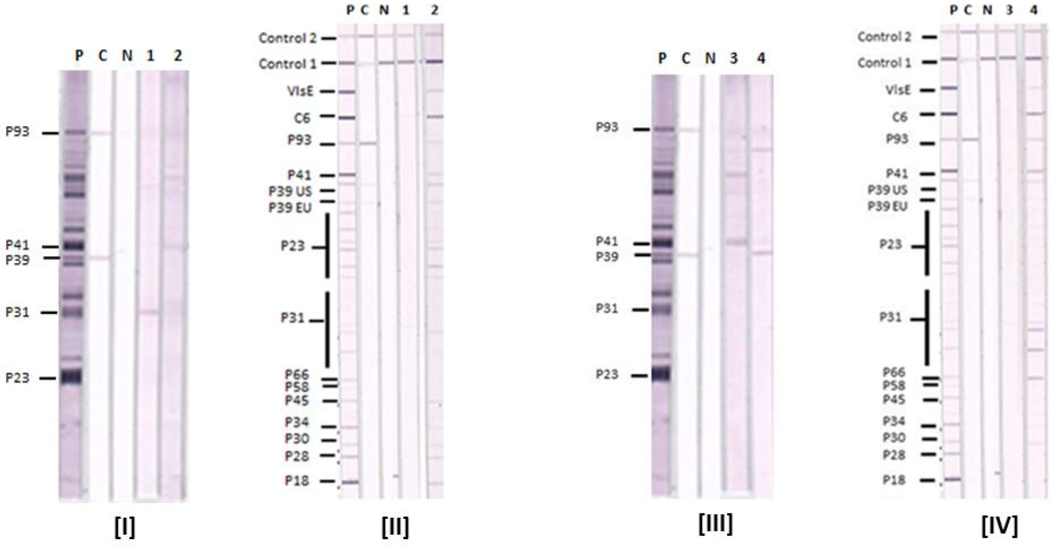 western blot test lyme