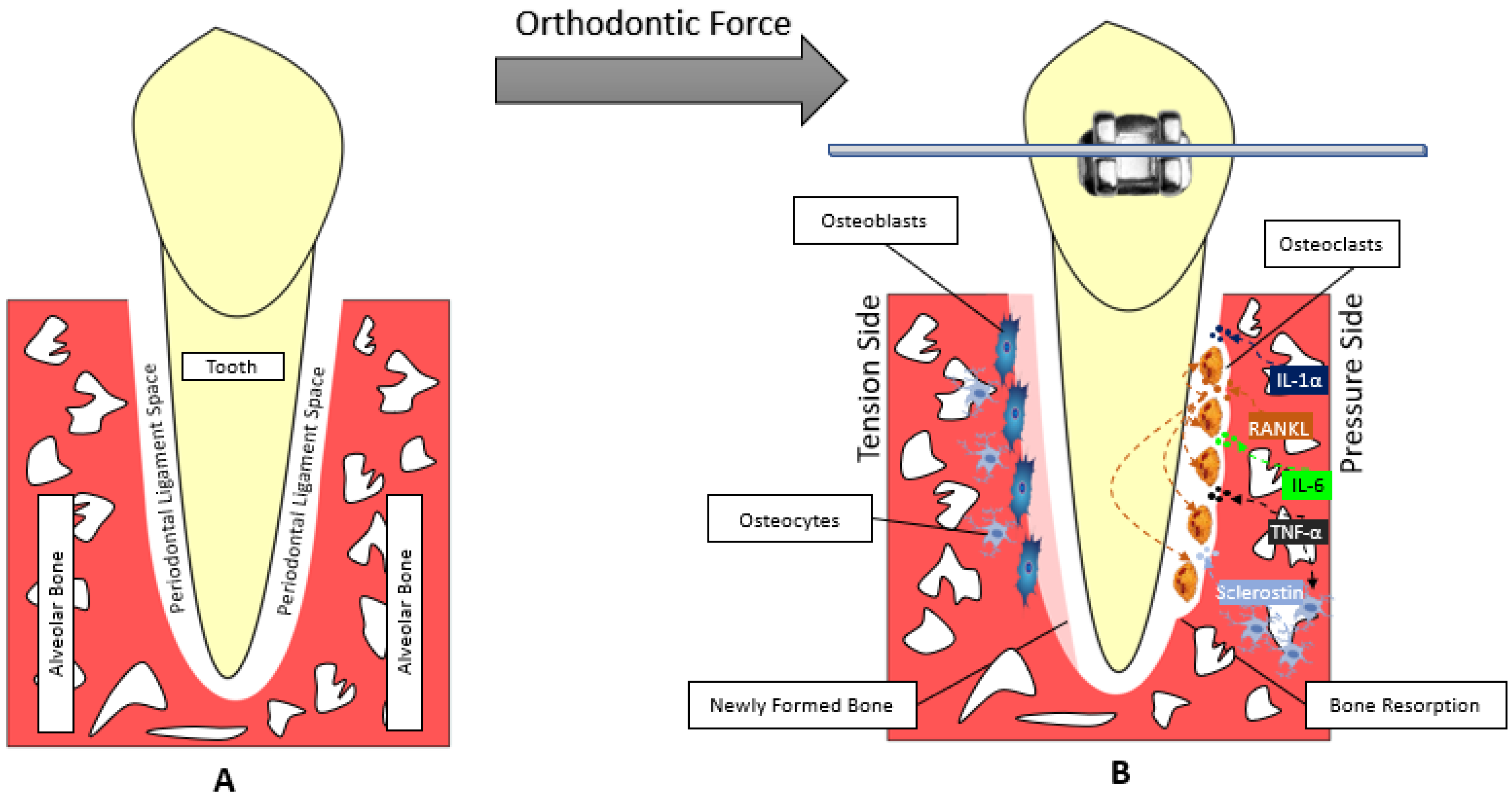 Healthcare Free FullText Sclerostin Modulation Holds Promise for