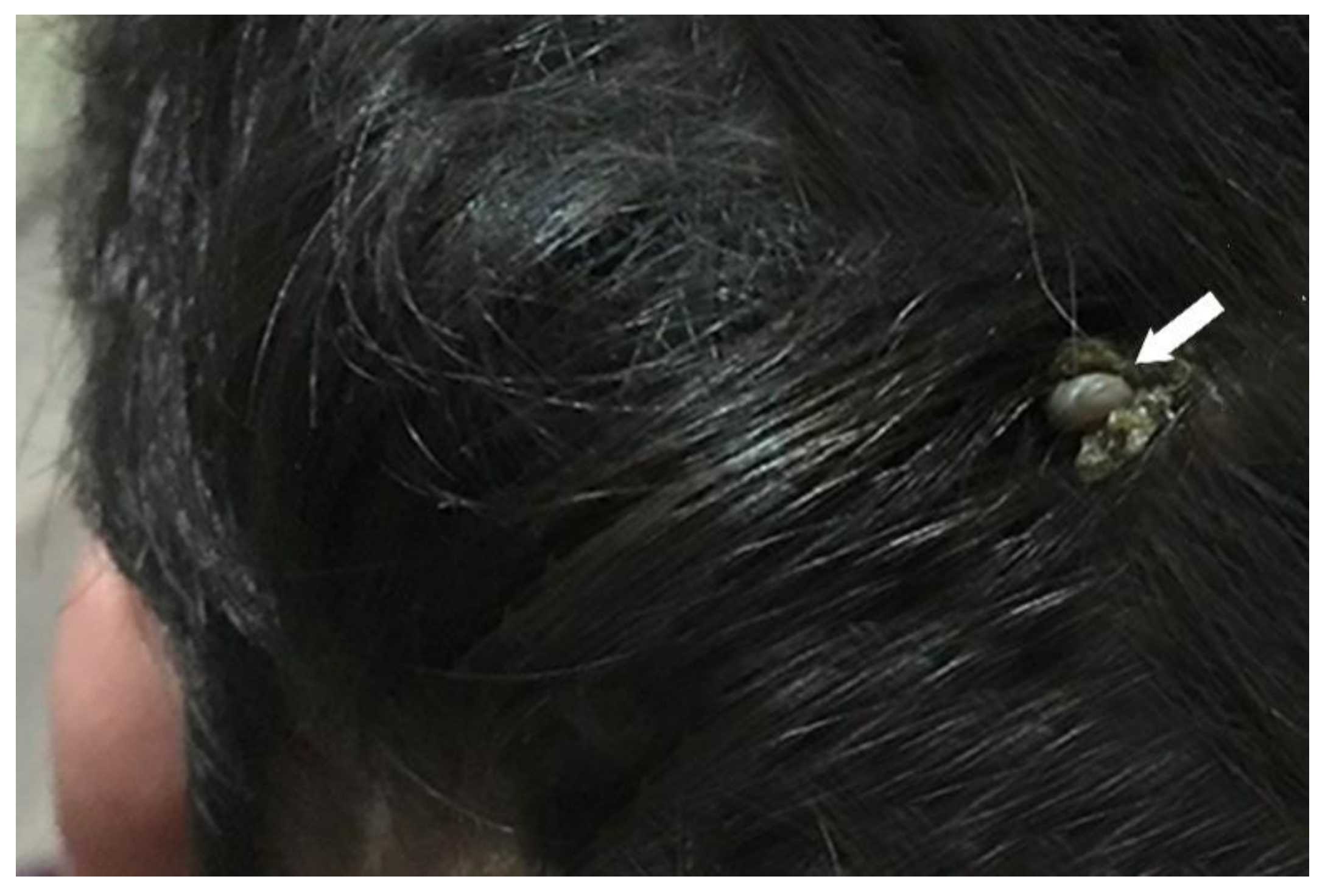 Process Four experimental Healthcare | Free Full-Text | Presence of Babesia odocoilei and Borrelia burgdorferi Sensu Stricto in a Tick and Dual Parasitism of Amblyomma inornatum and Ixodes scapularis on a Bird in Canada | HTML Process Four experimental Healthcare | Free Full-Text | Presence of Babesia odocoilei and Borrelia burgdorferi Sensu Stricto in a Tick and Dual Parasitism of Amblyomma inornatum and Ixodes scapularis on a Bird in Canada | HTML