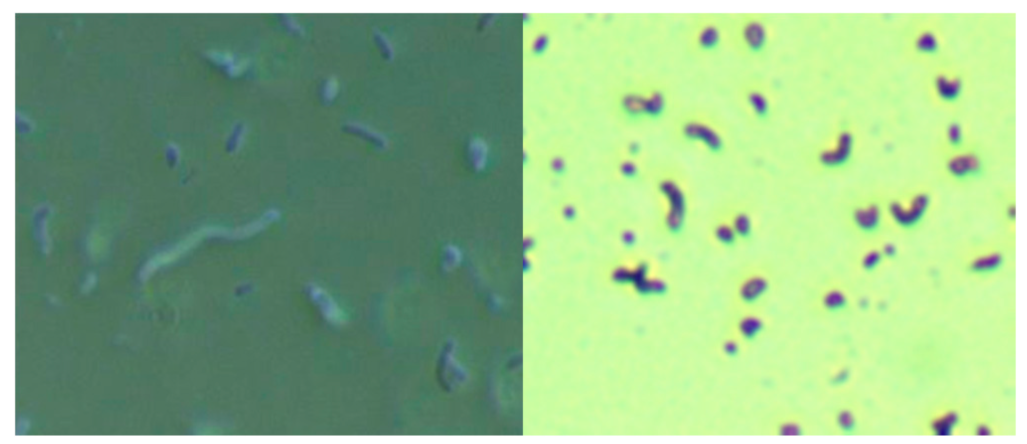 Определение хеликобактер в кале. Хеликобактер микроскопия. Helicobacter pylori микроскопия. Боррелия бургдорфери микроскопия. Хеликобактер пилори в Кале.