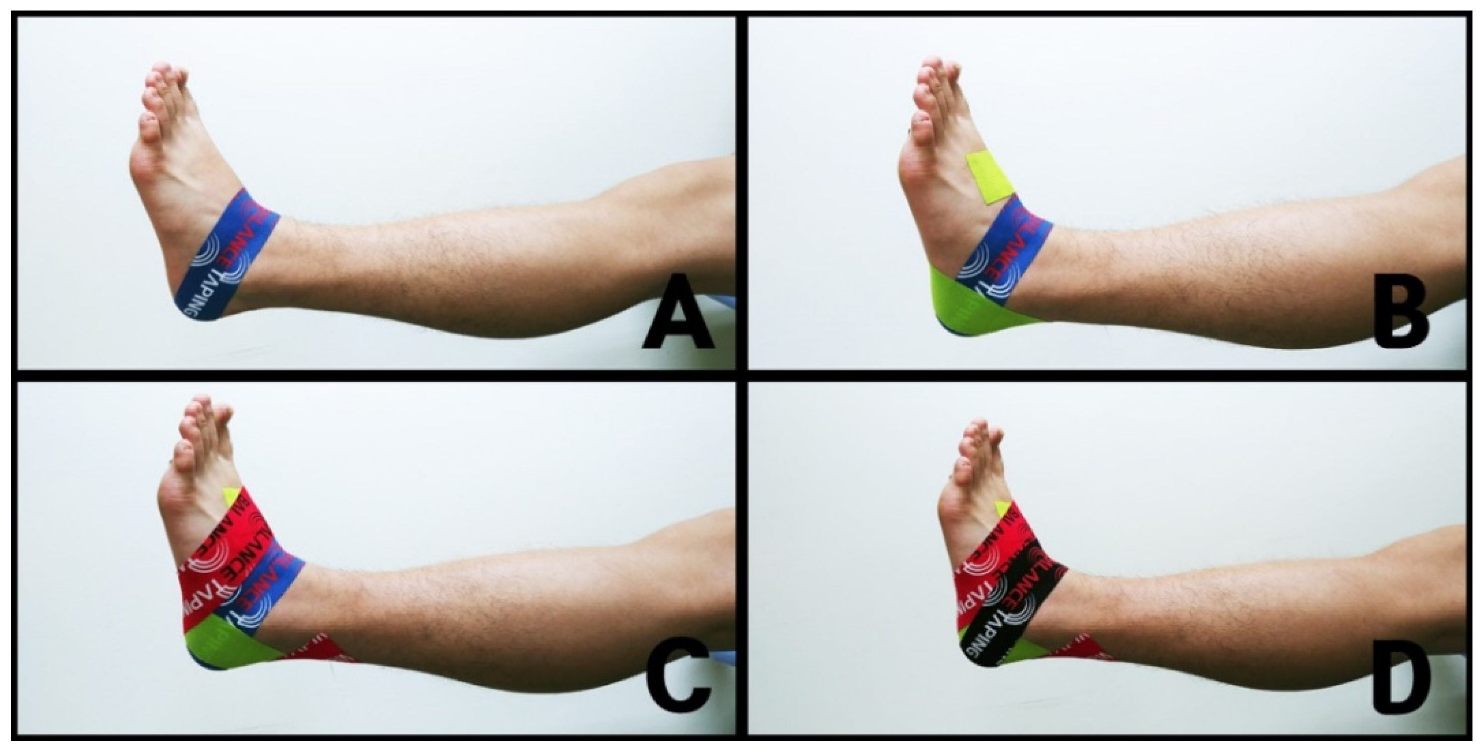Habubu kærtegn annoncere Healthcare | Free Full-Text | Immediate Effect of Balance Taping Using Kinesiology Tape on Dynamic and Static Balance after Ankle Muscle Fatigue Habubu kærtegn annoncere Healthcare | Free Full-Text | Immediate Effect of Balance Taping Using Kinesiology Tape on Dynamic and Static Balance after Ankle Muscle Fatigue