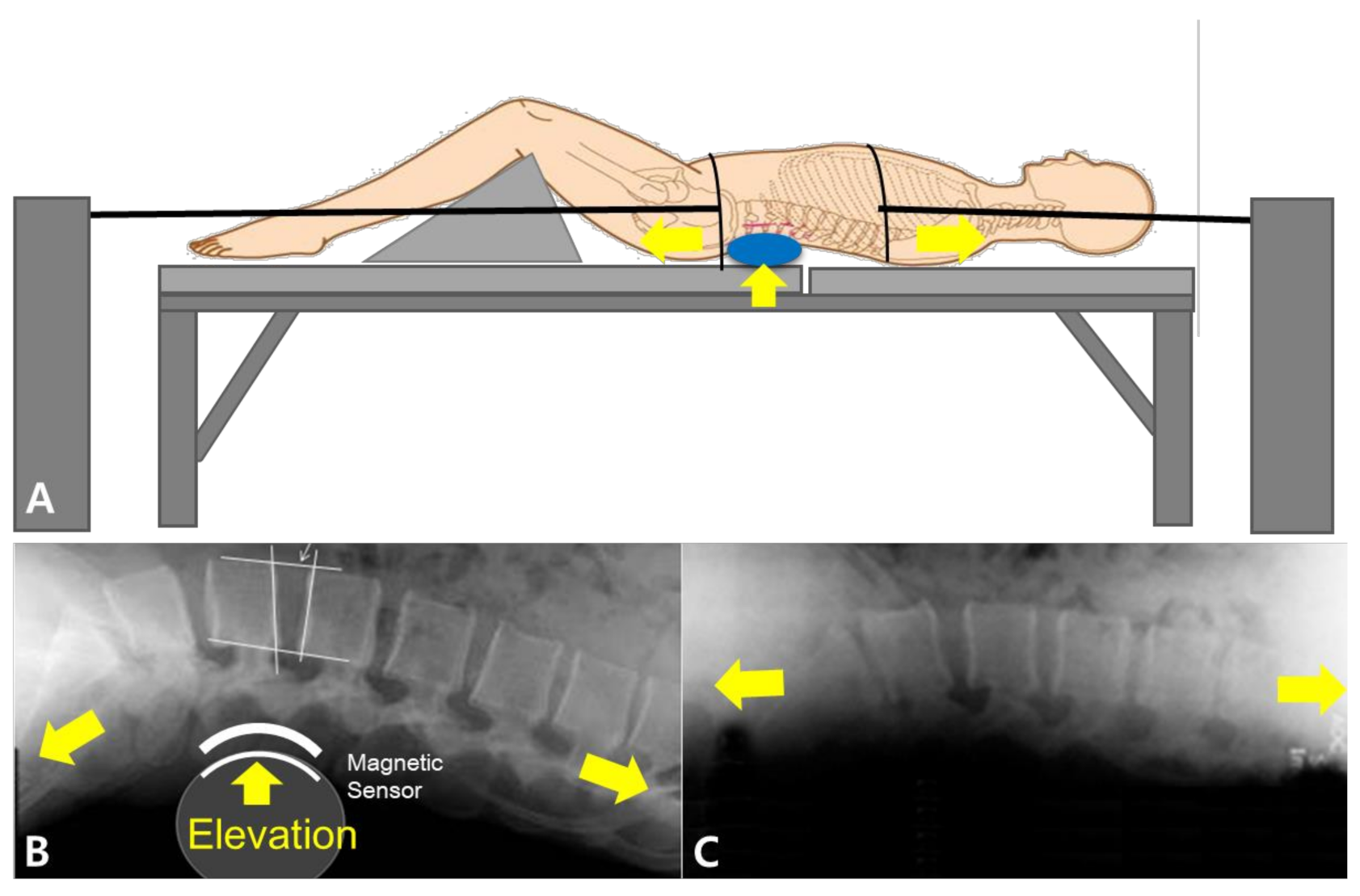 Healthcare Free FullText The Real Time Geometric Effect of a