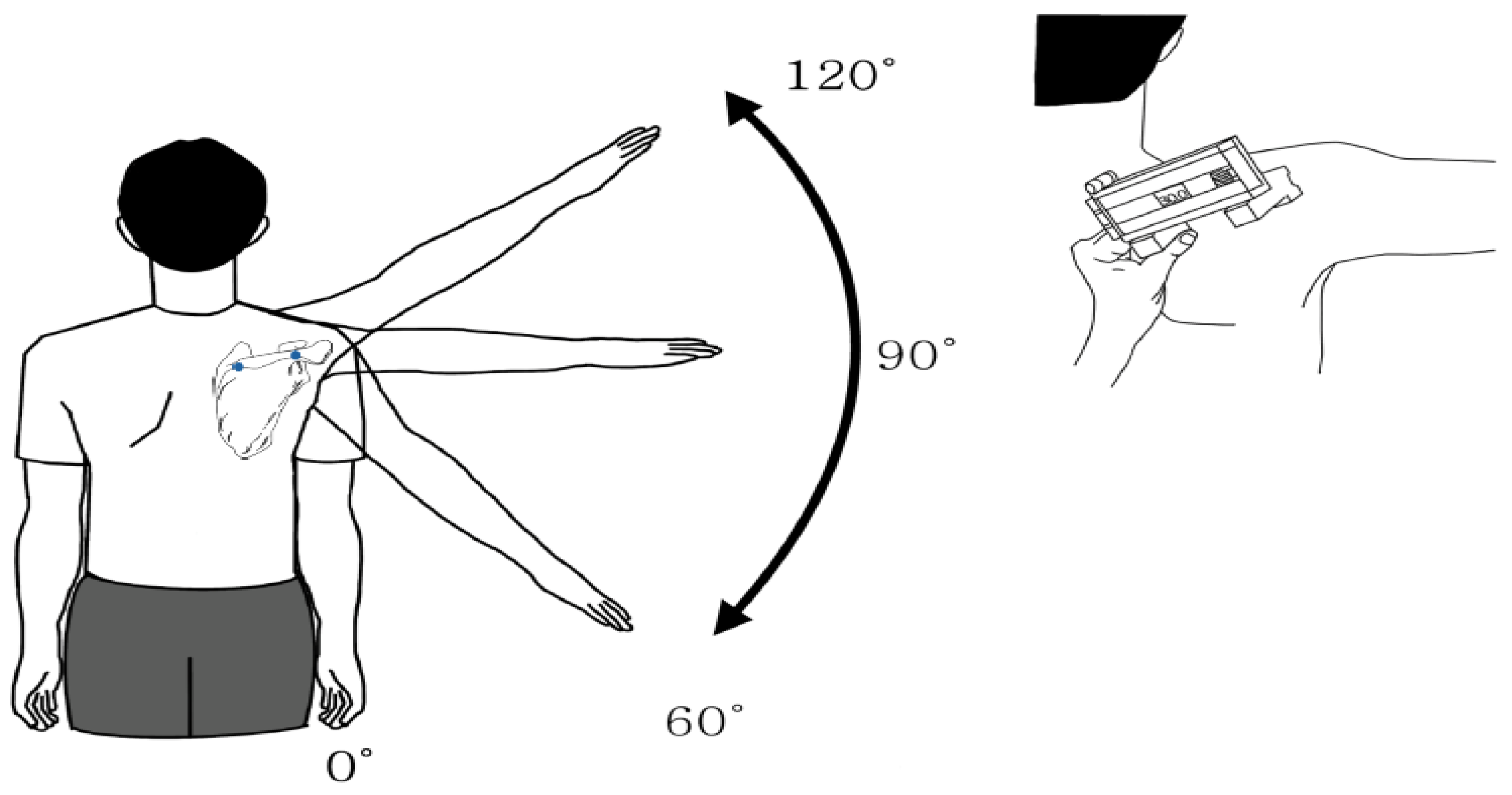 Healthcare Free Full-Text The Relationship between Scapular Upward Rotation and Shoulder Internal and External Rotation Isokinetic Strength in Professional Baseball Pitchers picture