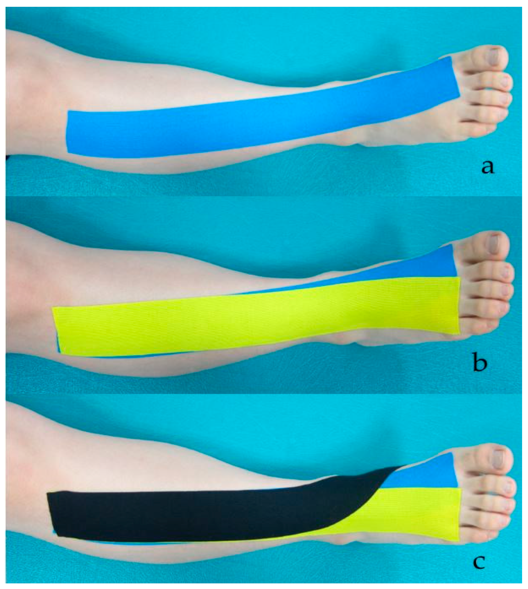 K-Taping in neurology as a therapy addition