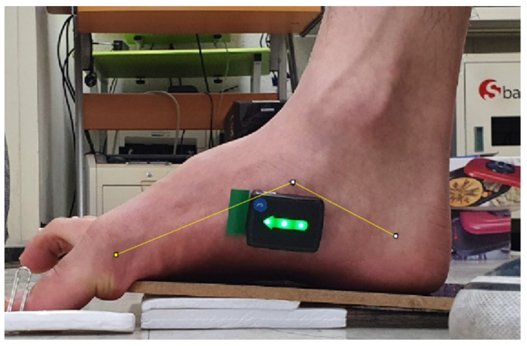 Healthcare Free Full-Text Effect of Peroneus Longus Muscle Release on Abductor Hallucis Muscle Activity and Medial Longitudinal Arch before Toe-Tap Exercise in Participants with Flexible Pes Planus