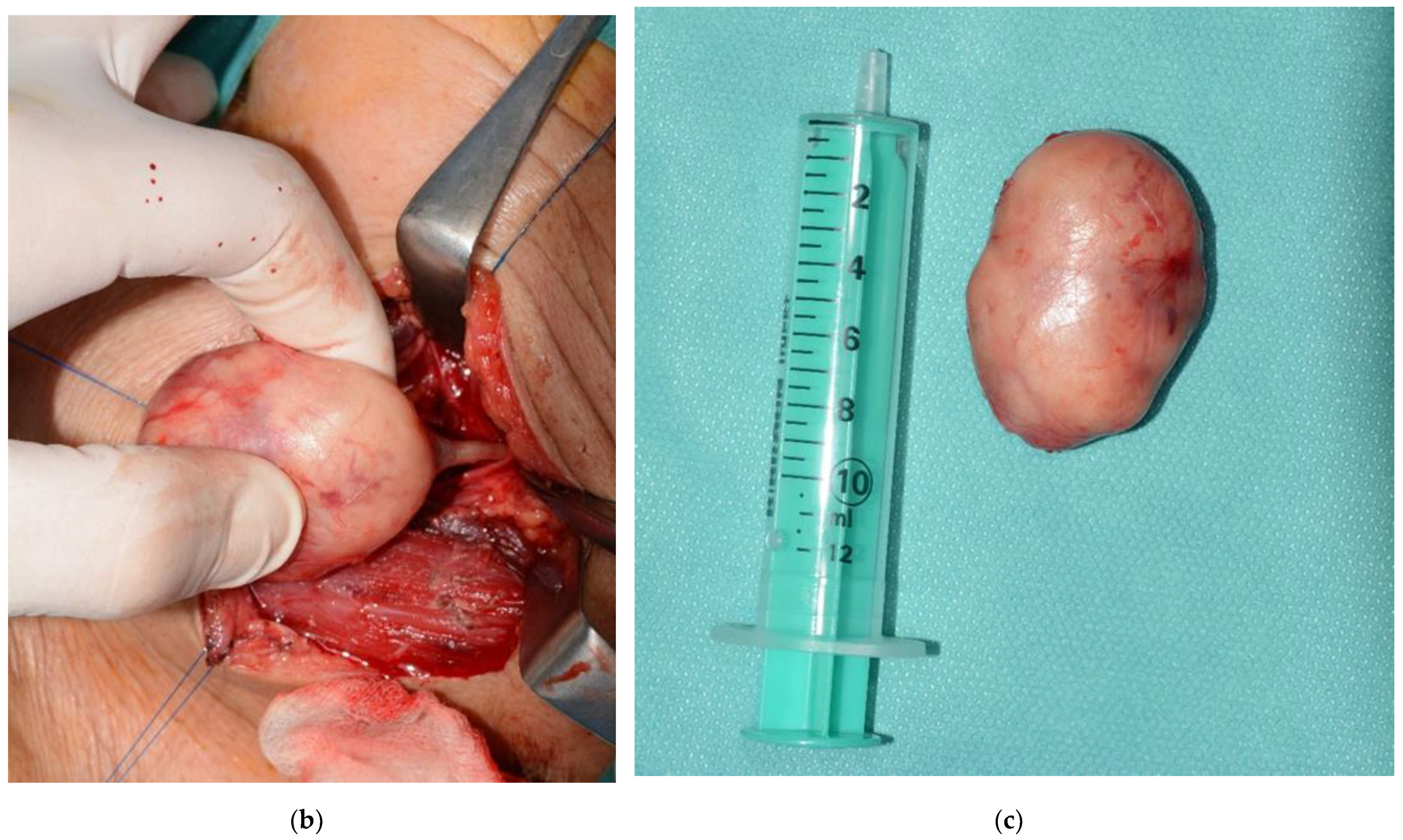 Healthcare 10 00059 g005b