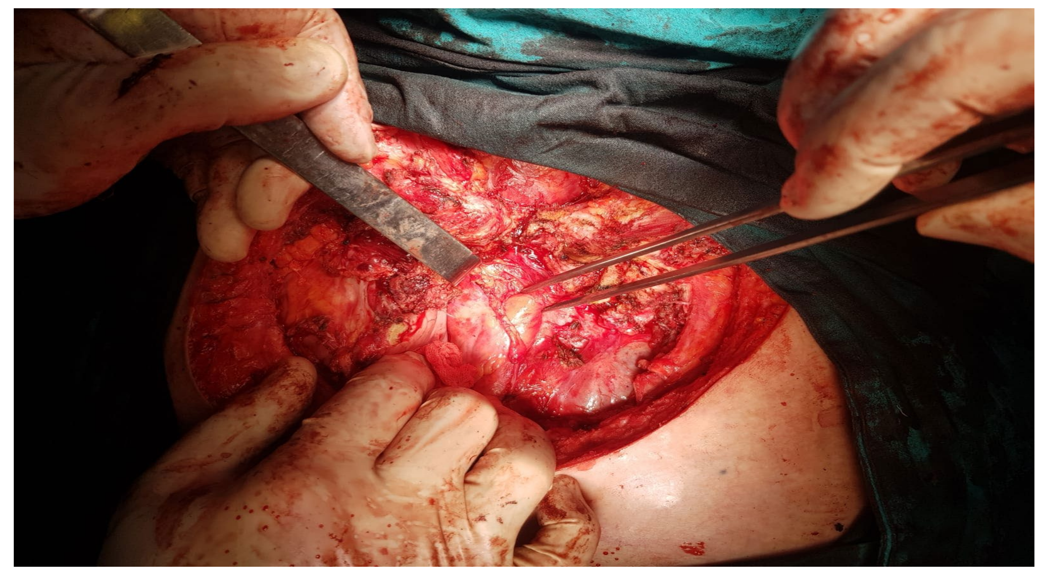 Healthcare 10 00158 g011 Healthcare 10 00158 g011