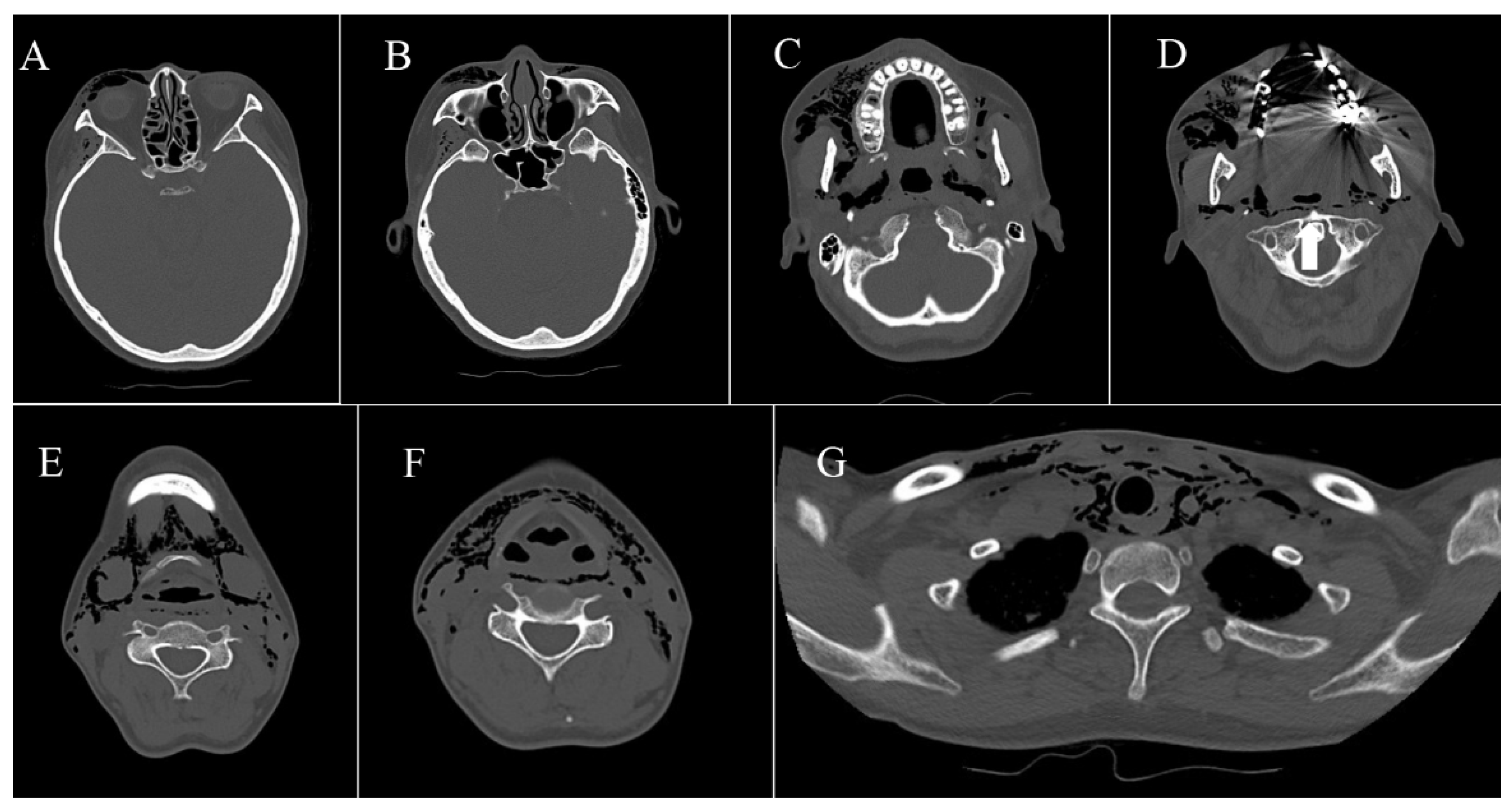 Healthcare 10 00290 g004
