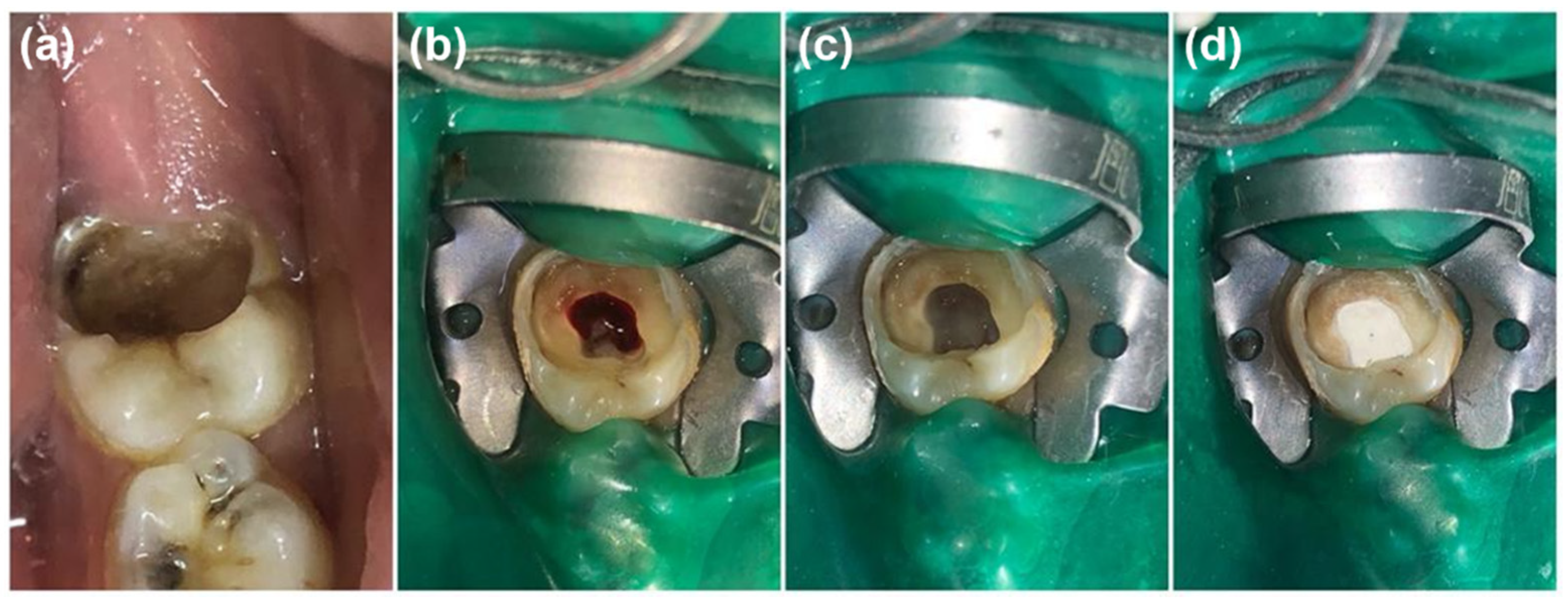 Healthcare 10 00431 g002 Healthcare 10 00431 g002