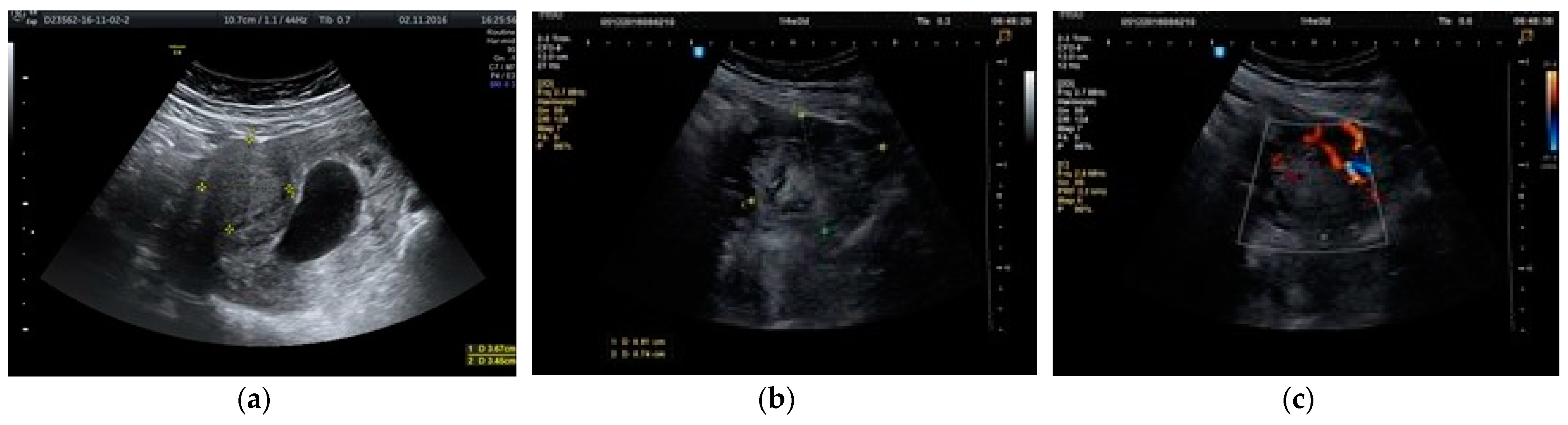 Healthcare 10 00855 g005