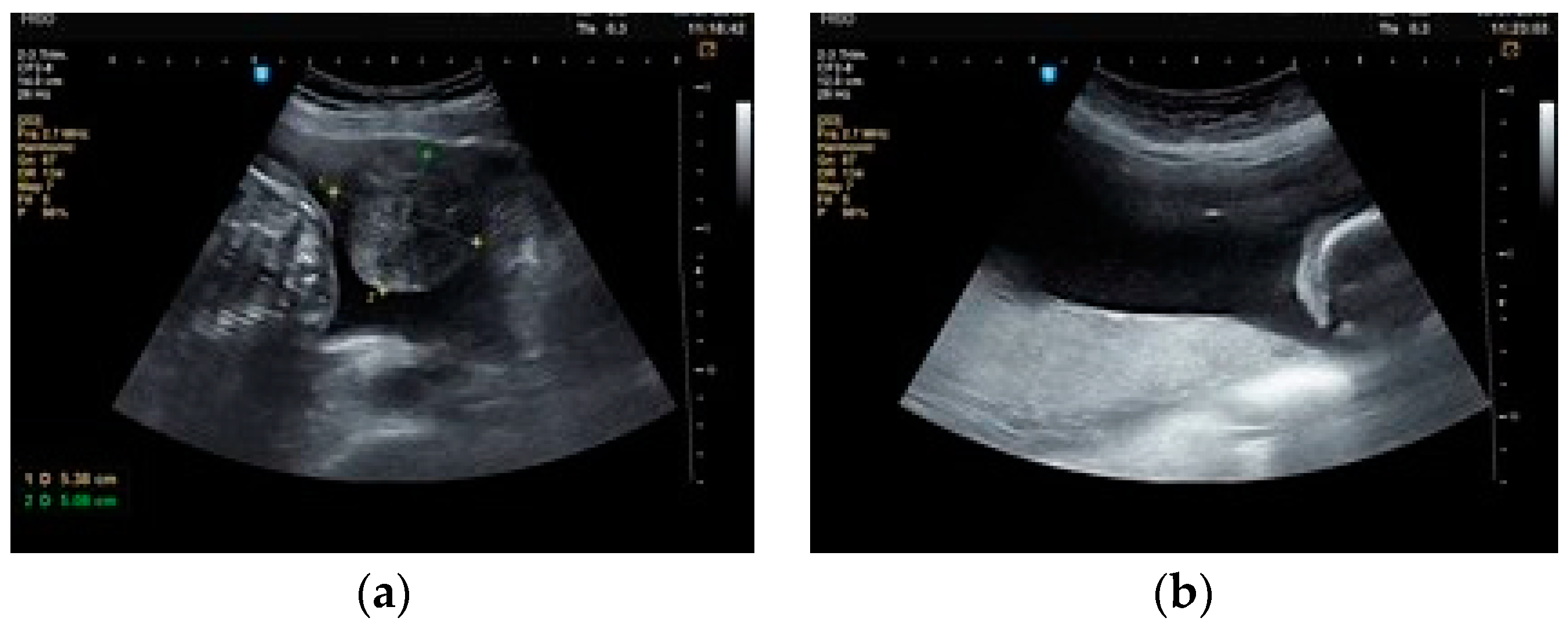 Healthcare 10 00855 g006