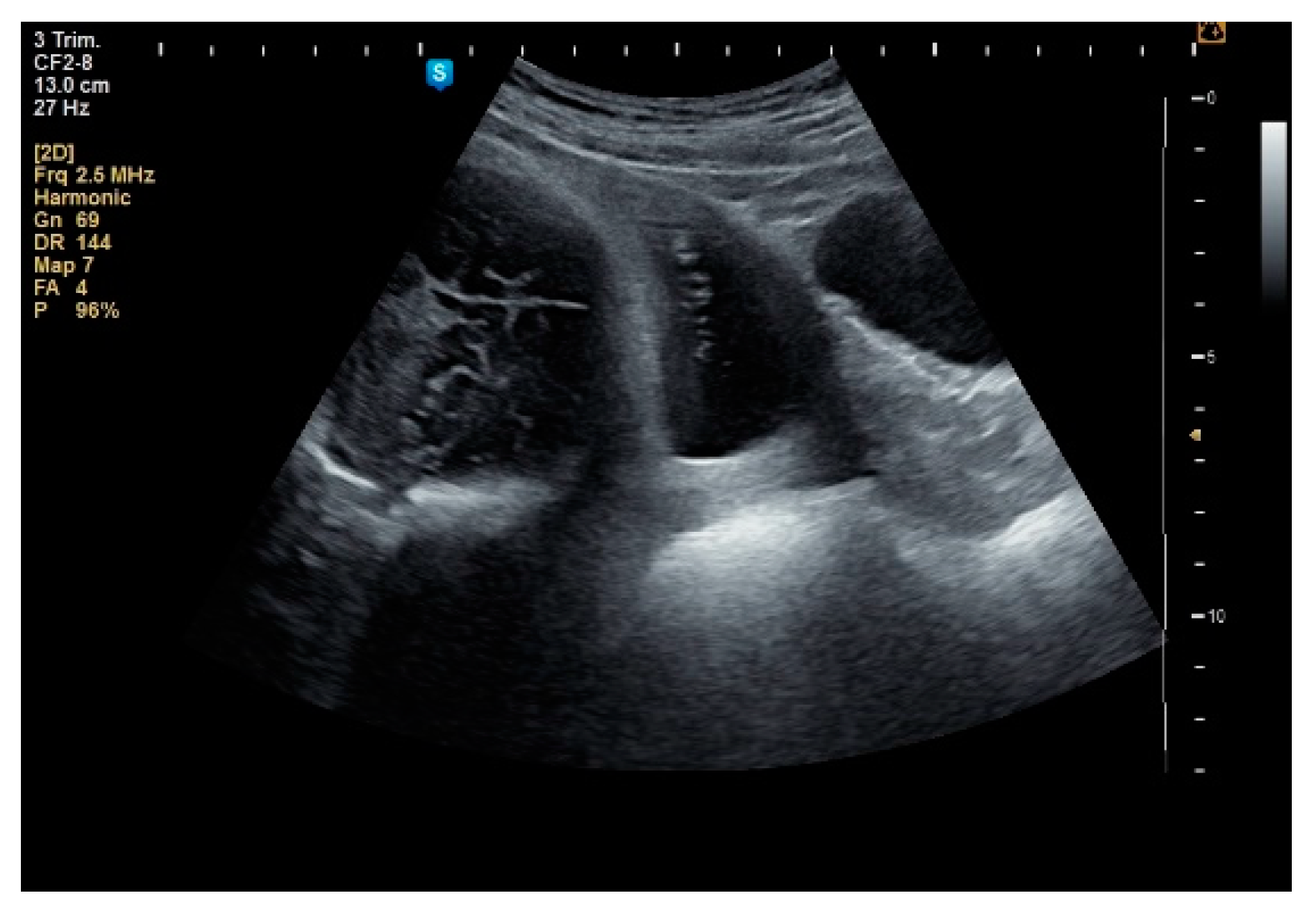 Healthcare 10 00855 g008