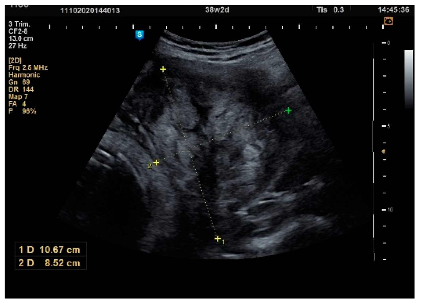 Healthcare 10 00855 g009