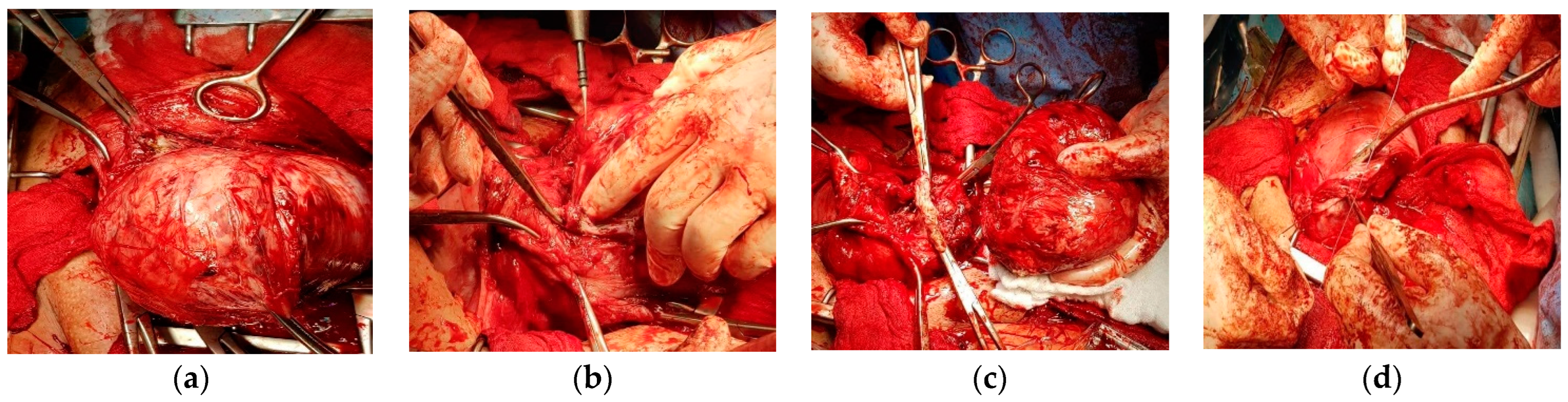 Healthcare 10 00855 g010