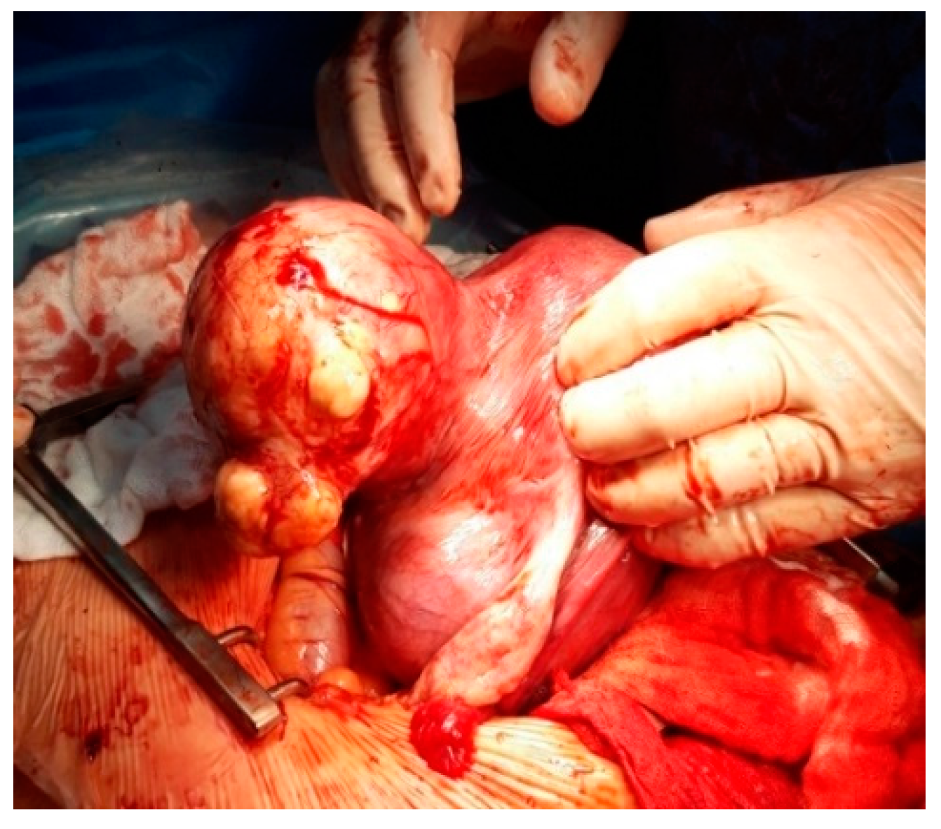 Healthcare 10 00855 g011