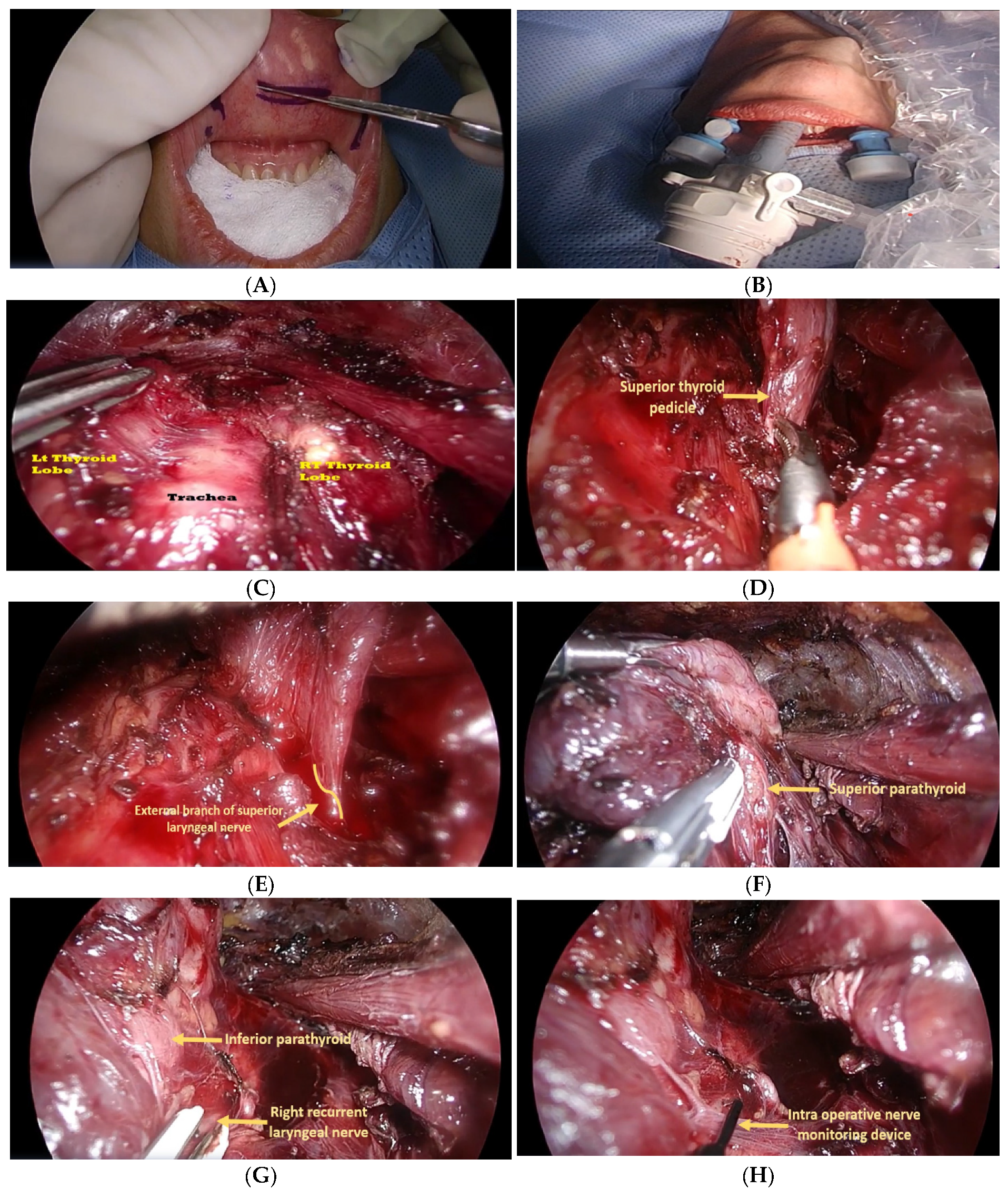 Healthcare 10 00953 g001 550