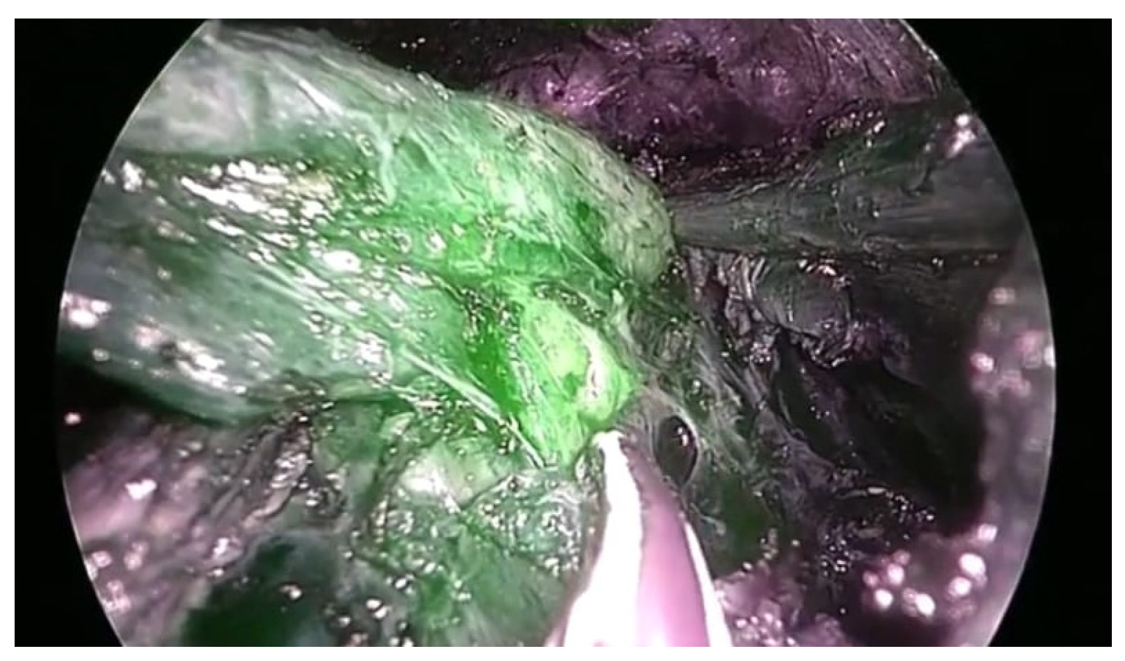 Healthcare 10 00953 g002 550