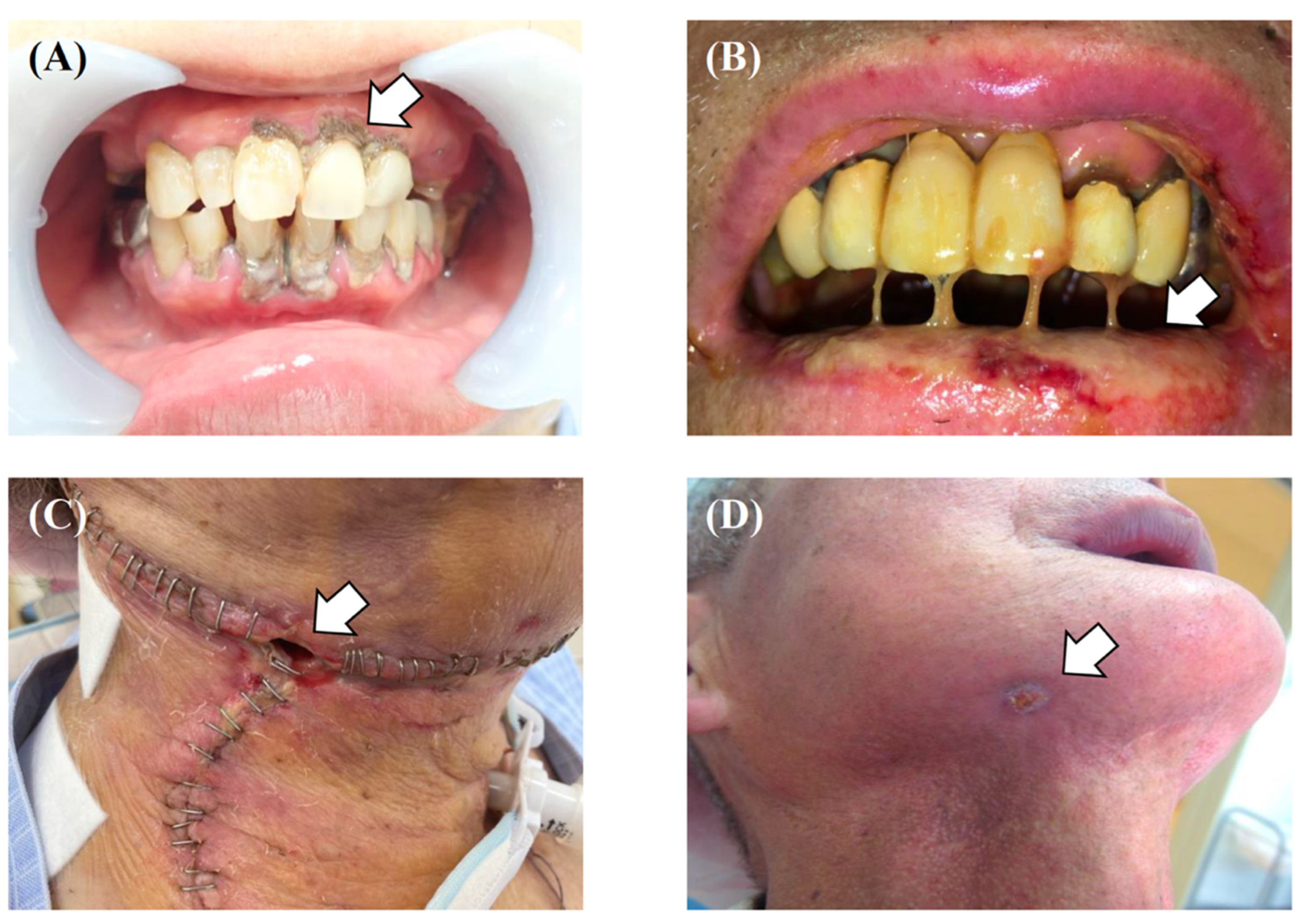 Healthcare 10 00960 g005 Healthcare 10 00960 g005