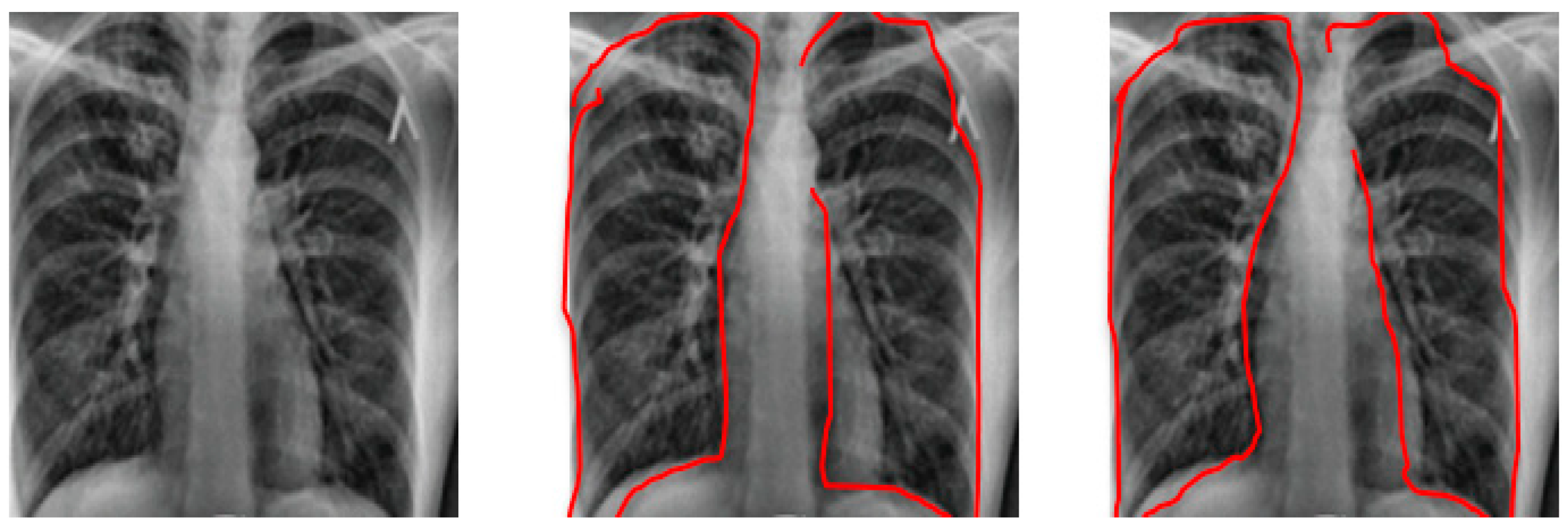 Healthcare 10 00987 g005 550