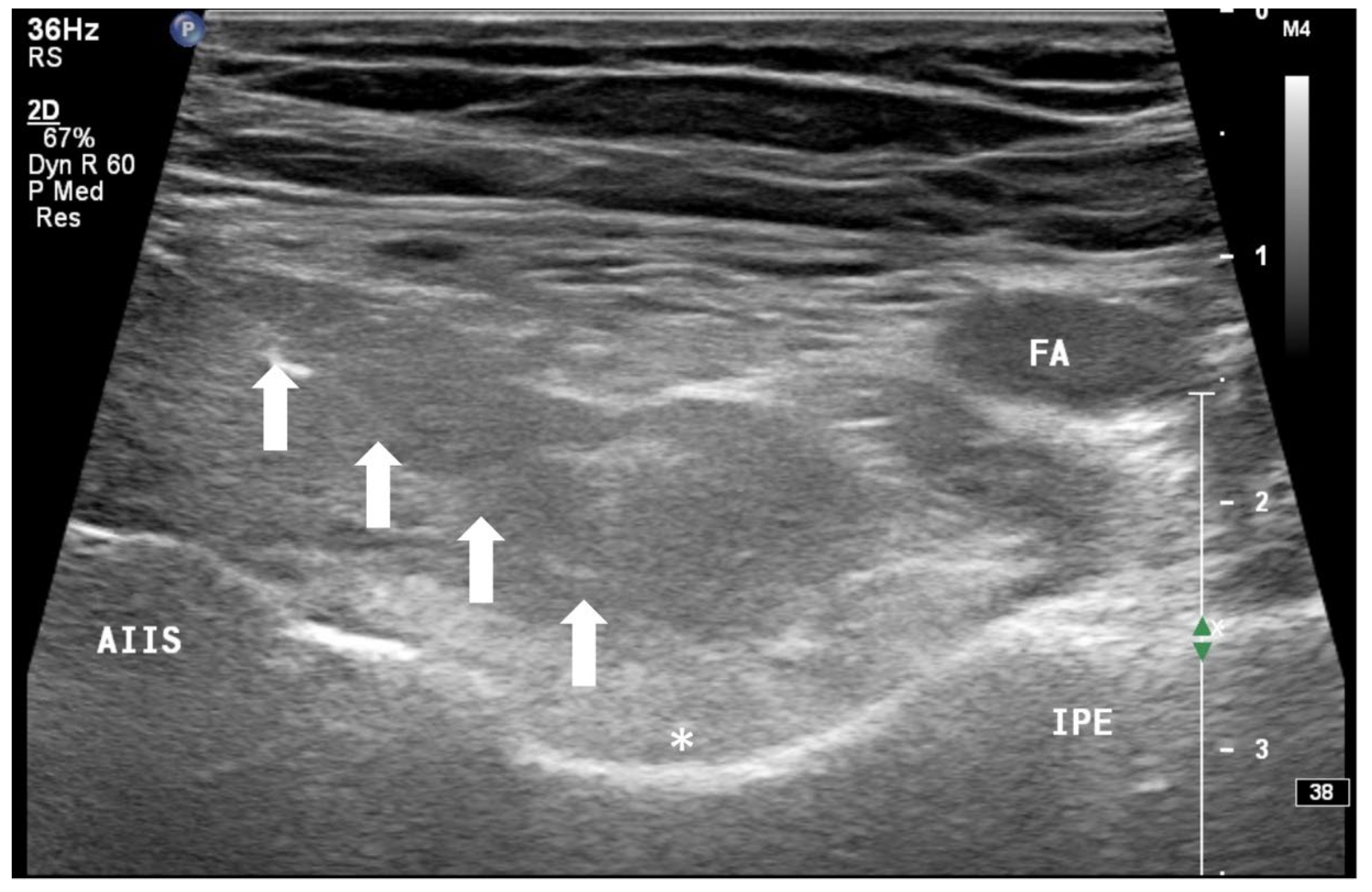 Healthcare 10 01002 g003 550