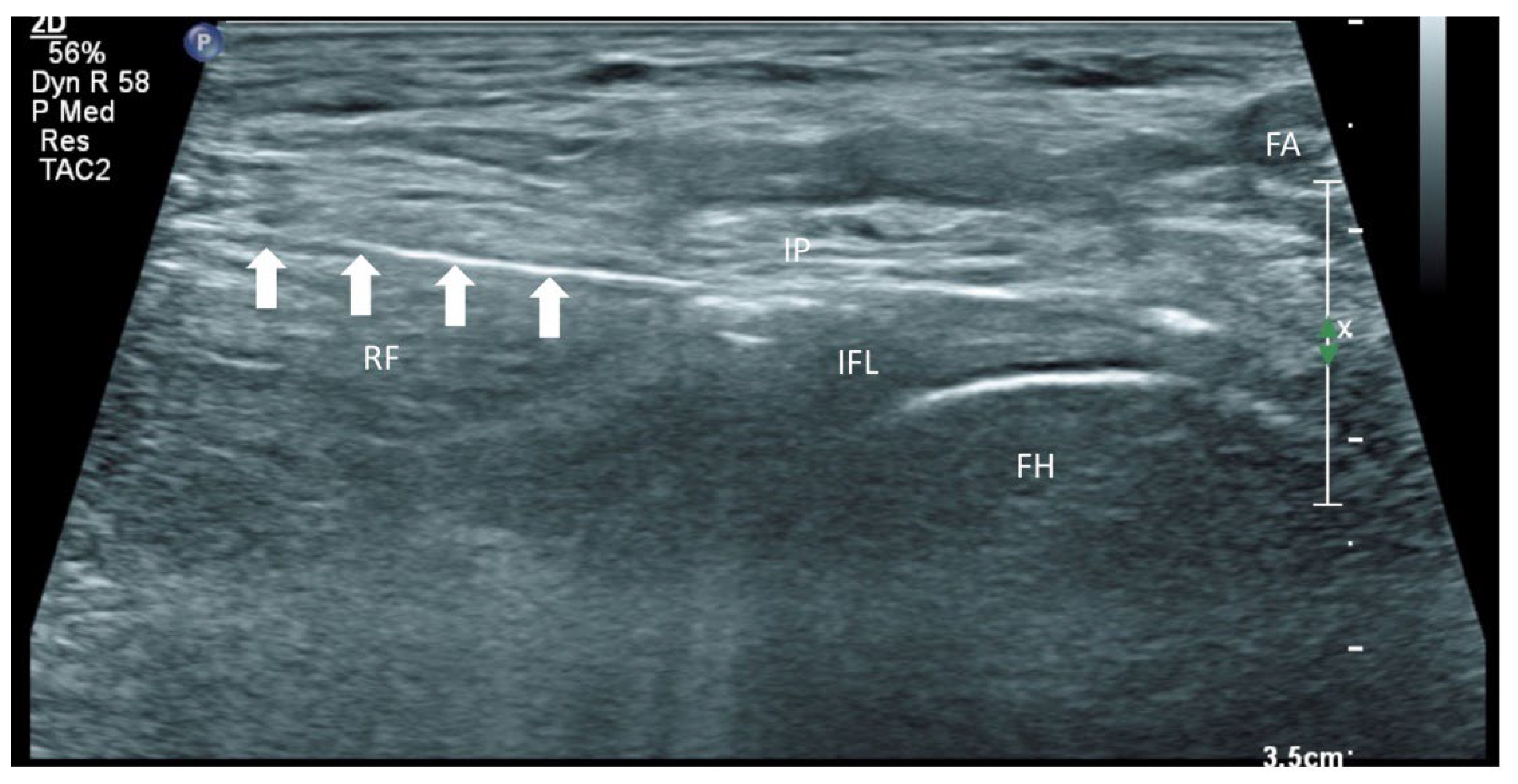 Healthcare 10 01002 g005 550