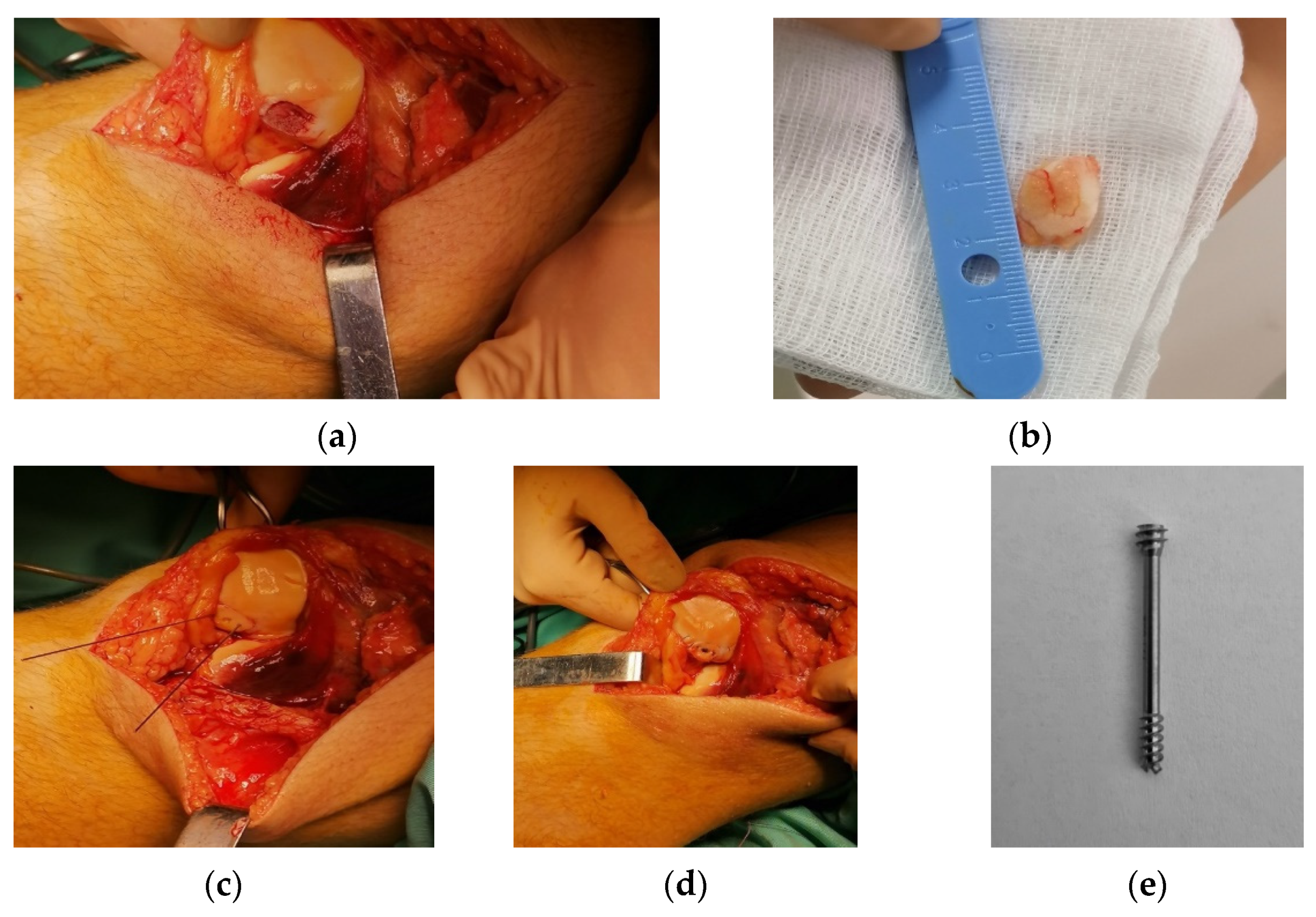 Healthcare 10 01061 g005