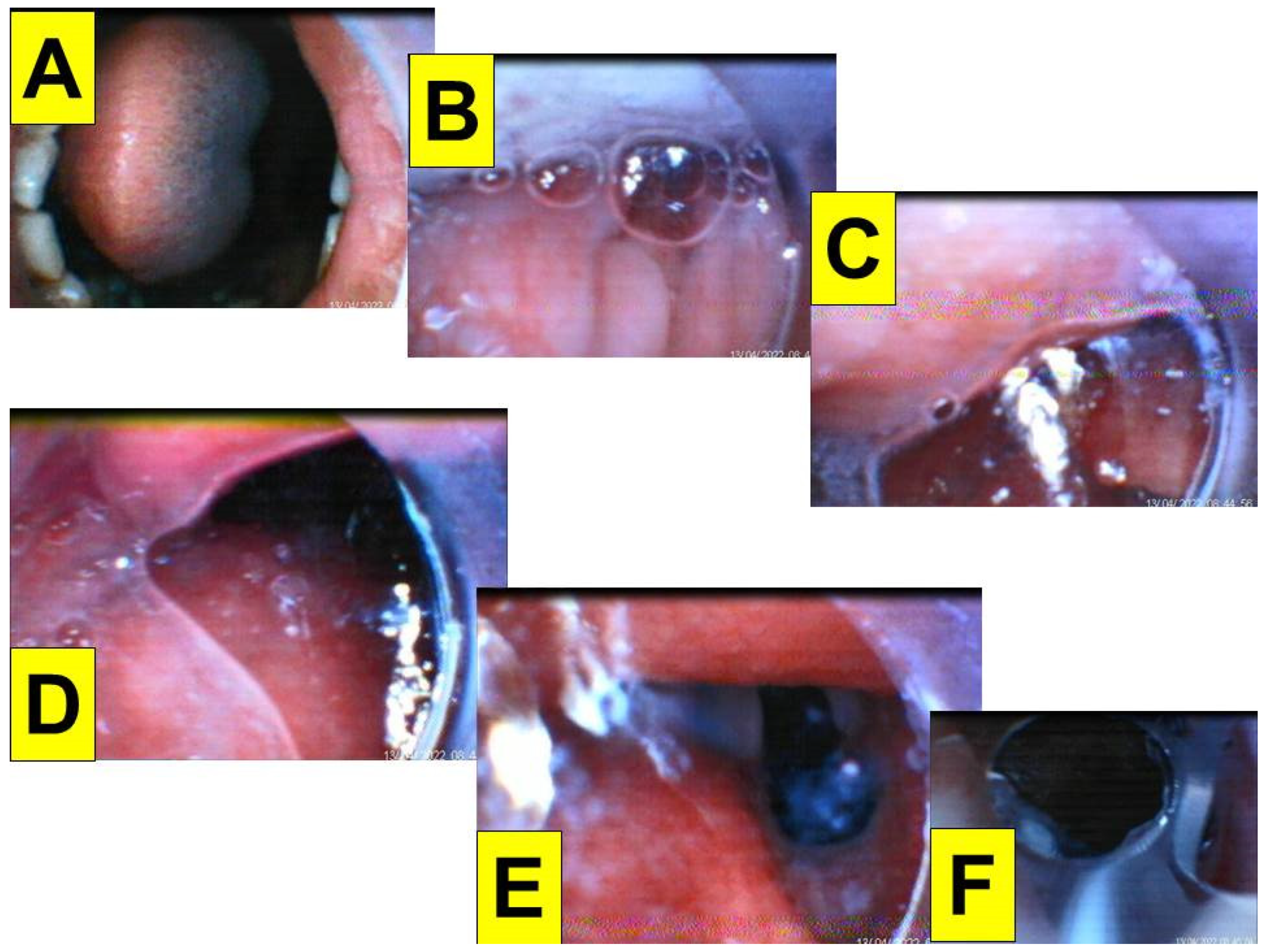Healthcare 10 01105 g005 550