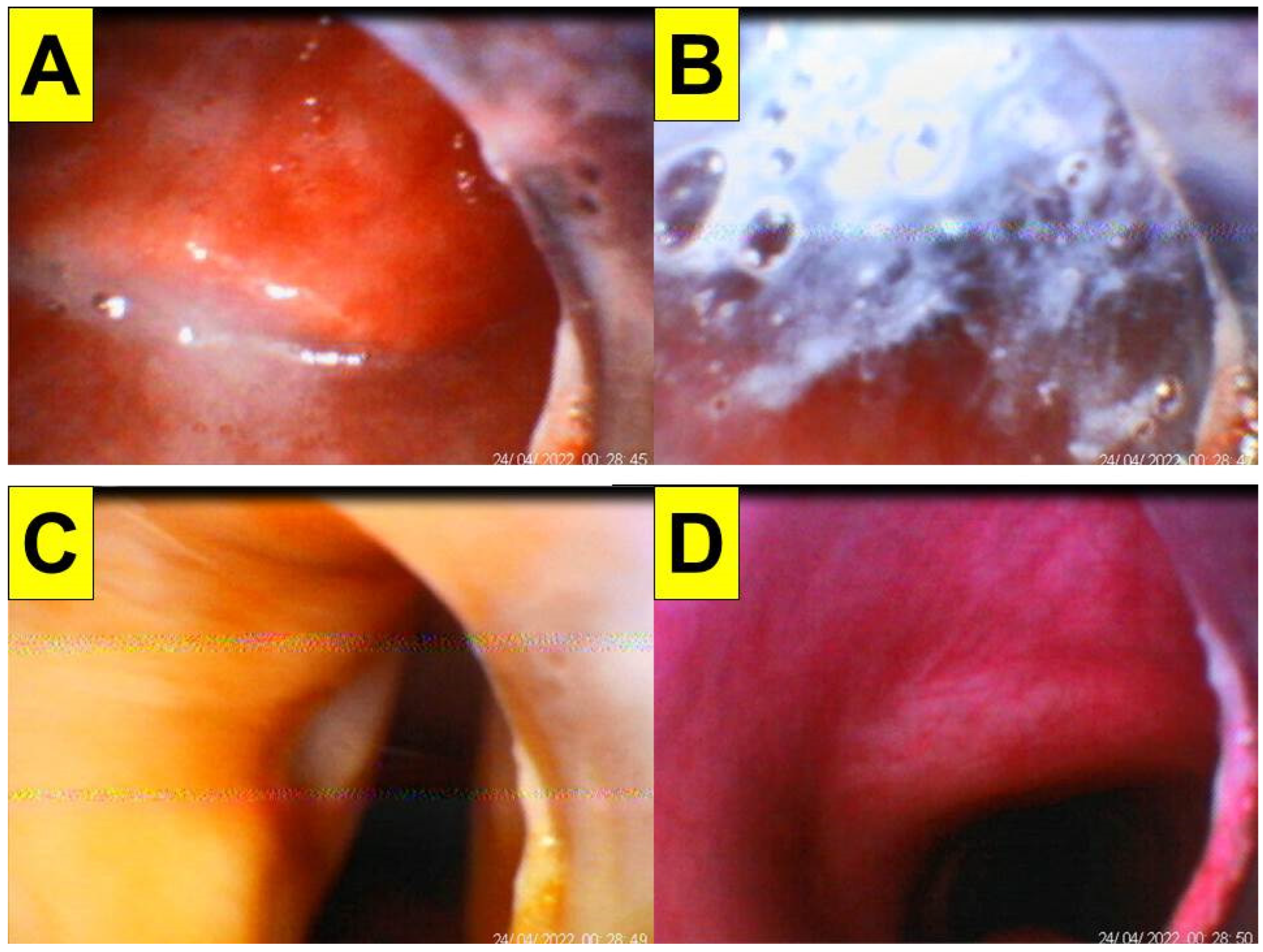 Healthcare 10 01105 g011 550